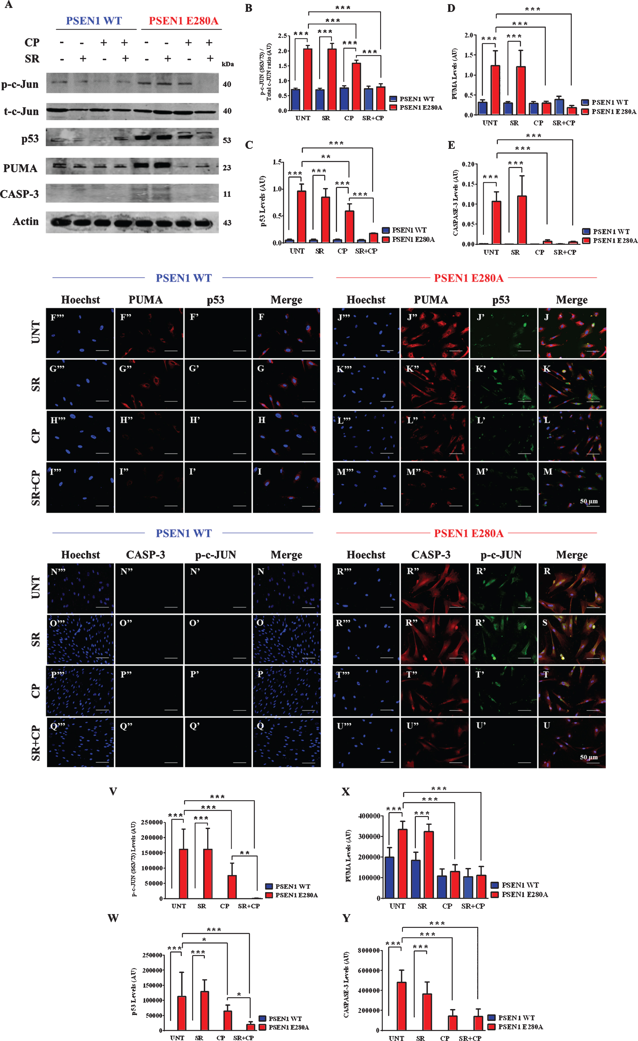 CP55940 reduced the activation of p53, PUMA, c-Jun, and caspase-3 independent of CB1Rs signaling in PSEN1 E280A ChLNs. After 7 days of transdifferentiation, WT PSEN1 and PSEN1 E280A ChLNs were left Untreated or treated with SR, CP, or SR + CP in regular culture medium for 4 days. After this time, the proteins in the extracts were blotted with primary antibodies against phosphorylated c-Jun (p-c-JUN)/total c-Jun, p53, PUMA, caspase-3 (CASP-3) and actin proteins. The intensities of the western blot bands shown in (A) were measured (B-E) by an infrared imaging system (Odyssey, LI-COR), and the intensity was normalized to that of actin. Additionally, cells were double-stained as indicated in the figure (F-U) with primary antibodies against p53 (green; F’-M’), PUMA (red; F”-M”), c-JUN (green; N’-U’), and CASP-3 (red; N”-U”). The nuclei were stained with Hoechst 33342 (blue; F”’-U”’). V-X) Quantification of c-JUN (V), p53 (W), PUMA (X), and CASP-3 (Y) fluorescence intensity. Data are expressed as the mean±SD; *p < 0.05; **p < 0.01; ***p < 0.001. The blots and figures represent 1 out of 3 independent experiments. Image magnification, 200×.