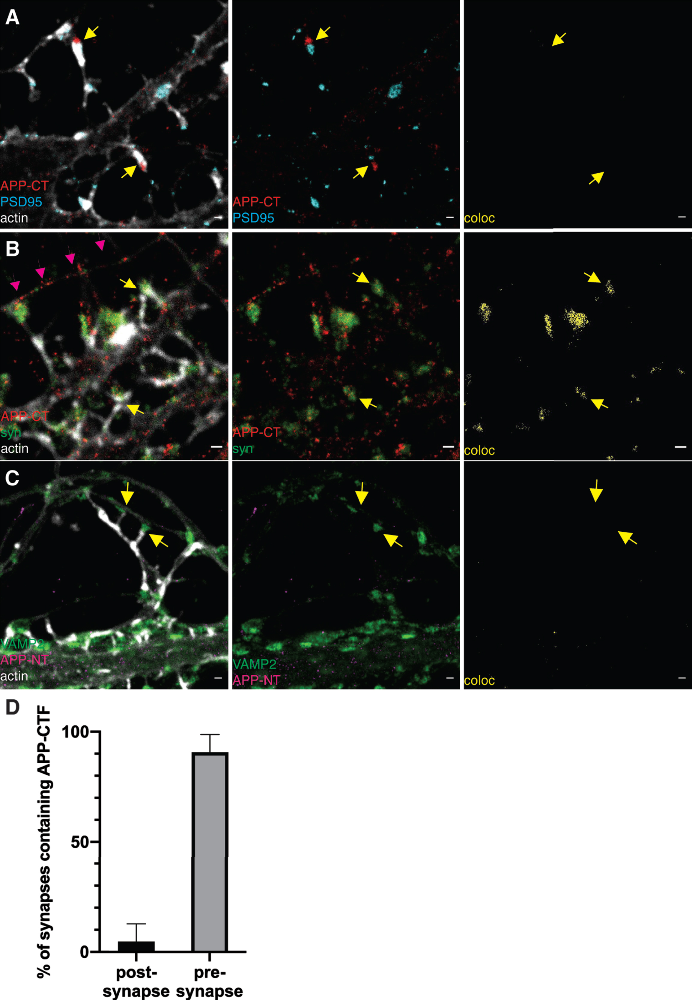 STED images of APP-CTF and synaptic markers in neurites. Immunolabeling and 2-channel STED imaging was used to visualize APP-CTF and synaptic markers in neurites of hippocampal neurons. A third, confocal, channel was used to image the actin cytoskeleton (phalloidin staining). Scale bar for all pictures: 500 nm. A) APP-CT (red), PSD95 (cyan) and actin in a confocal channel (white). Synapses showing PSD95 at the postsynaptic spines and APP-CT at the presynaptic side are marked with yellow arrows. Images show, from left to right, all channels, APP-CT and PSD95 and colocalization of APP-CT and PSD95, respectively. The absence of yellow color indicates no colocalization. B) APP-CTF (red), synaptophysin (syn; green) and actin in a confocal channel (white). Synapses showing synaptophysin and APP-CT at the presynaptic side close to postsynaptic spines are shown by yellow arrows. Magenta arrows mark the staining of APP-CT in the “free” axon. Images show, from left to right, all channels, APP-CT and synaptophysin, colocalization of APP-CT and synaptophysin. C) APP-NT (magenta), VAMP2 (green) and actin in a confocal channel (white). The presynaptic side of two synapses is marked by yellow arrows. Images show, from left to right, all channels, APP-NT and VAMP2 and colocalization of APP-NT and VAMP2. D) Quantification of APP-CT in pre- or post-synaptic side. Data were quantified from 3 different batches of hippocampal neurons, 20 synapses for each. All error bars represent mean±sd.