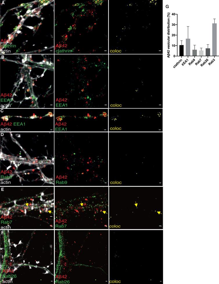 STED images of Aβ42 and subcellular markers in neurites. 2-channel STED imaging combined with actin staining (white) in a confocal channel. The colocalization between Aβ42 and subcellular markers is shown to the right in yellow. A) Aβ42 (red) and clathrin (green). B, C) Aβ42 (red) and EEA1 (green). D) Staining of Aβ42 (red) and Rab9 (green). E) Aβ42 (red) and Rab7 (green). F) Aβ42 (red) and Rab26 (green). Scale bars for all pictures: 500 nm. G) Distribution of Aβ42 staining in neurites. Data were quantified from 3 different batches of hippocampal neurons for each subcellular marker. All error bars represent mean±sd. Analysis was done by “particle analyze” in ImageJ. Threshold “Moments” was applied for the Aβ42 channel. Threshold “Triangle” was applied for the subcellular markers channel.
