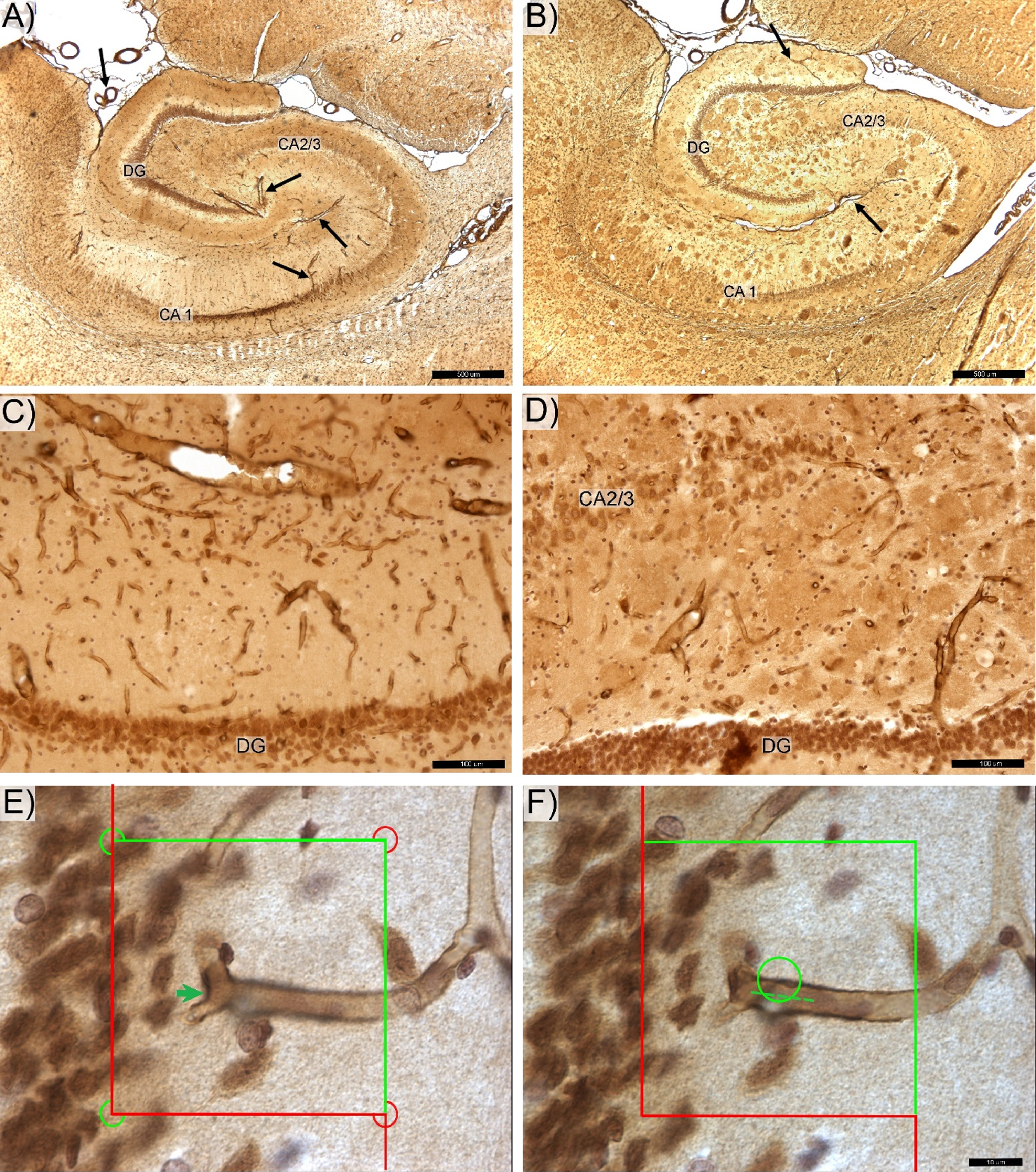 Photomicrograph of the anti-laminin antibody labeled hippocampal microvessels in control (A,C) and transgenic (B,D) rats. DG -, CA 2/3-, and CA1-labeled respective zone of the pyramidal cells layer. The magisterial vessels, serve as the main source of hippocampal blood supply (black arrows). E) Total number of capillary segments (Euler number) was quantified by counting “saddle points” (green arrow) using the 3D optical disector probe. F) Total capillary length was determined using the Space Balls method based on number of intersections between surface of the virtual 3D sphere probe and centerline (spline) of each capillary (dotted line). Space bars: A,B –500 μm; C,D –100 μm; E,F –20 μm.