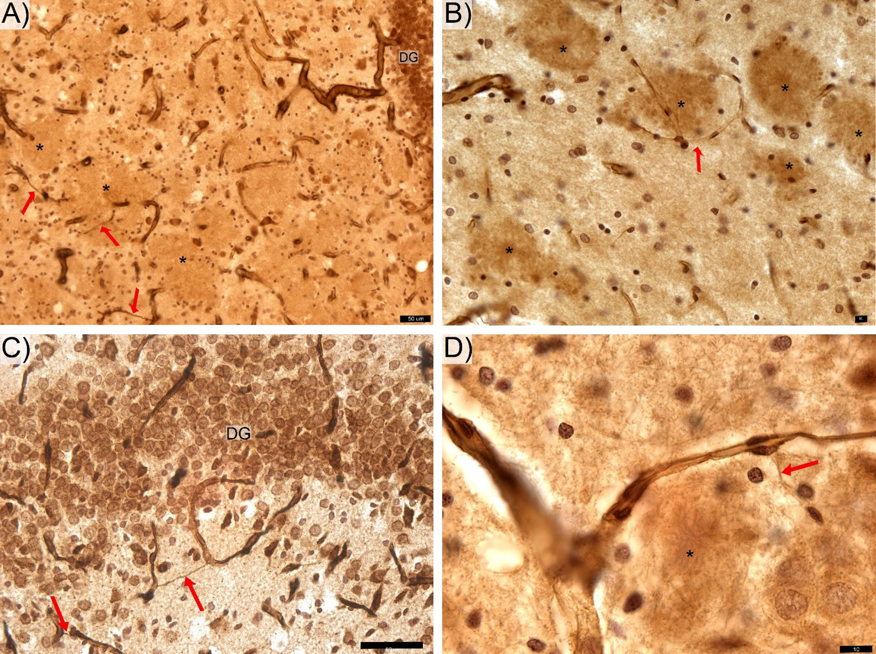 Features of thin hair-like capillaries (red arrows) commonly find in TgF rats. DG-, CA 2/3-, and CA1-labeled respective zone of the pyramidal cells layer. The anti-laminin antibody labeled hippocampal sections from the transgenic rats contain areas of with clear contours (*) appear as likely locations of Aβ deposition. Space bars: A,C – 50 μm; B, D – 10 μm.