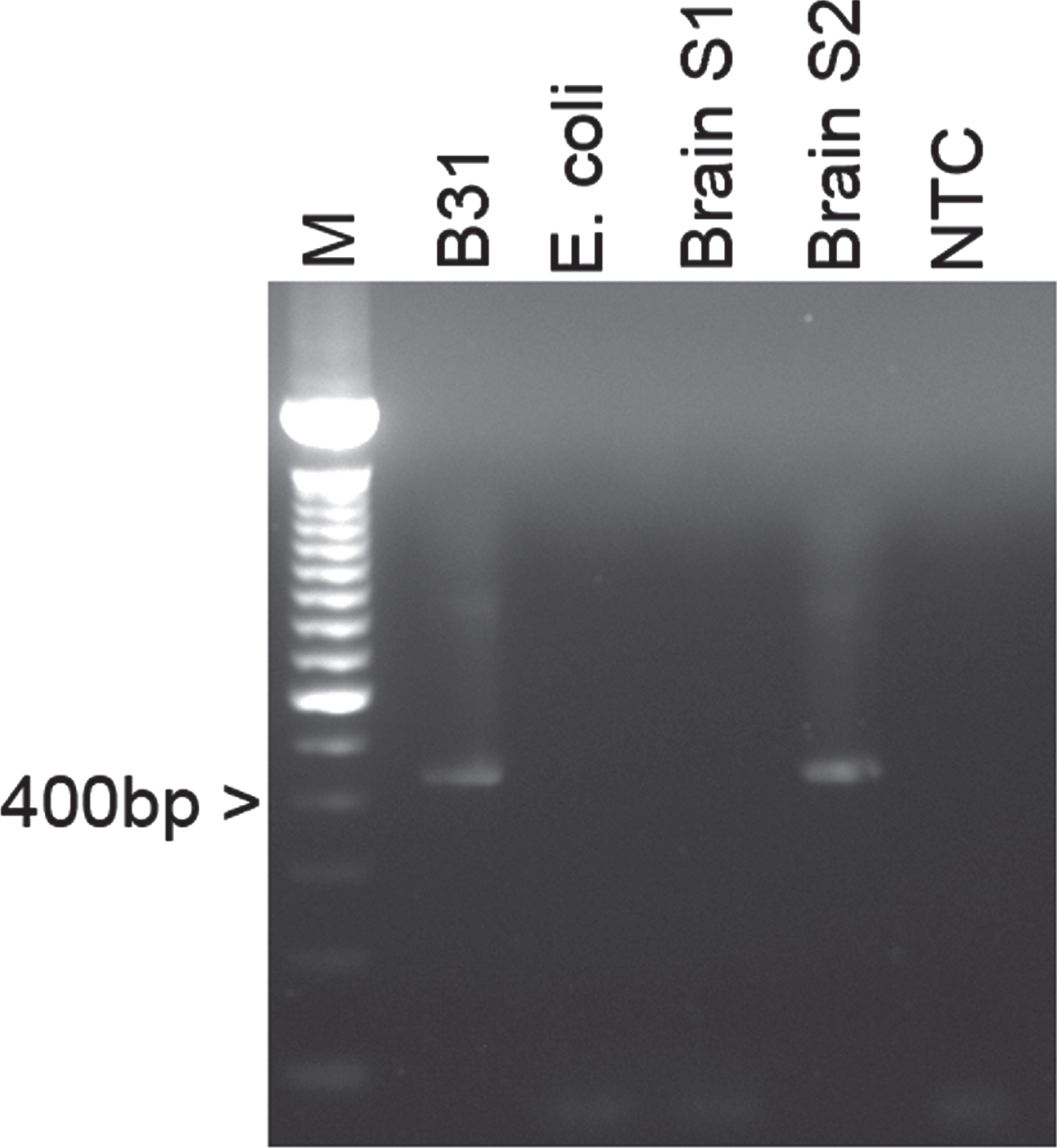 Representative agarose gel image of a B. burgdorferi specific 16S rDNA PCR amplification of genomic DNAs from brain autopsy tissues. Lane 1 : 1 kB DNA Ladder (Life Technologies), Lane 2: Extracted genomic DNA from B. burgdorferi B31 laboratory strain, Lane 3: Genomic E. coli DNA as a negative control, Lanes 4-5: Genomic DNA from human brain autopsy sections from the frontal lobe (S1) and the hypothalamus area (S2), Lane 6: No template control.