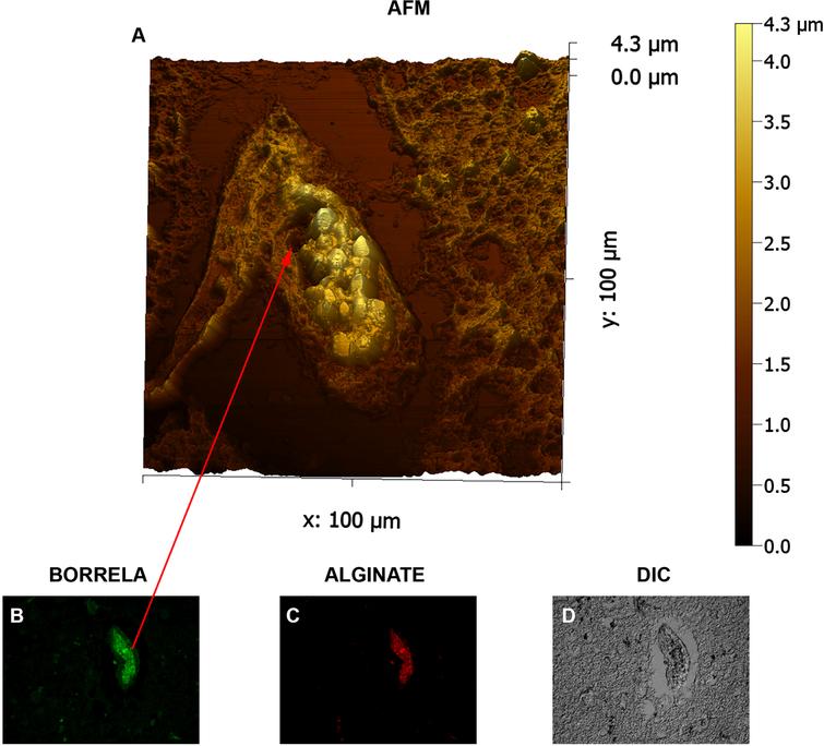 Three-dimensional atomic force microscopy analyses of Borrelia/alginate-positive aggregates from a human brain tissue section. Panel A shows a representative image from the AFM analyses which was performed using contact mode of the Nanosurf Easyscan 2 AFM with SHOCONG probe (AppNANOTM). Images were processed, and measurements were obtained using Gwyddion software. The individual height and width ranges are indicated on the panels. Panel B and C shows evidence that the scanned tissue is Borrelia- and alginate-positive by fluorescent IHC analyses (400x magnification). Panel D shows DIC imaging to visualize the tissue. Red arrows represent the same area of the tissue illustrated on panel A. Panels D shows tissue morphology with DIC microscopy. Scale bar: 100μm