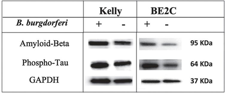 Expression of Aβ and p-Tau proteins in infected and non-infected cells. Western blot analysis of protein expression of Aβ (95 KDa), p-Tau (64 KDa), and GAPDH (37 KDa) of the 48 h of B. burgdorferi infected and uninfected Kelly and BE2C cell lines.