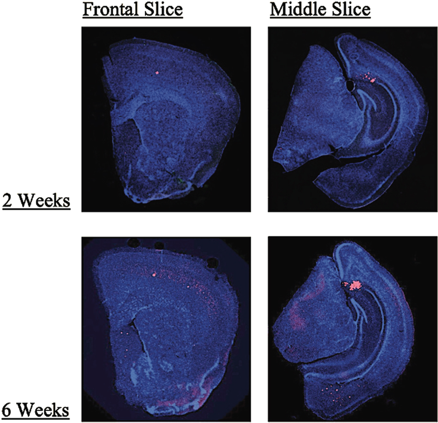 Examples front and midbrain coronal slices of 3xTgAD mice taken at 2x magnification in the 2-week and 6-week treatment groups showing greater Aβ plaque accumulation (red) in the 6-week group as compared to the 2-week group (blue = DAPI, red = Aβ). The largest change in plaque load found in the septum as shown in the frontal slices.