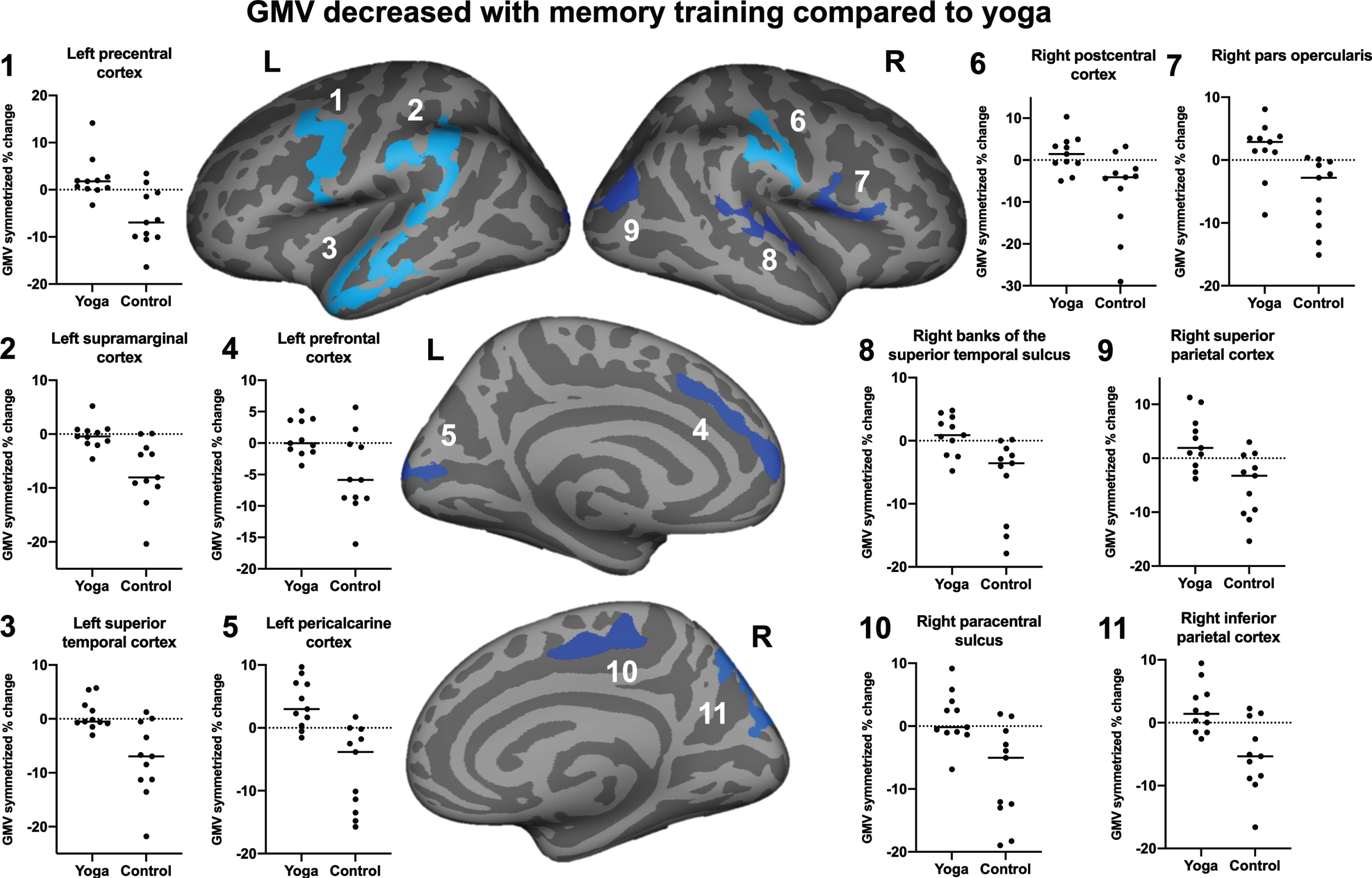 Clusters showing group differences in GMV change. The MET group showed reductions in GMV in all eleven clusters across the brain over a 3-month time frame, while the yoga group showed significant increases in the left precentral (1) and lateral occipital cortices or GMV remained stable pre-to-post intervention (5).