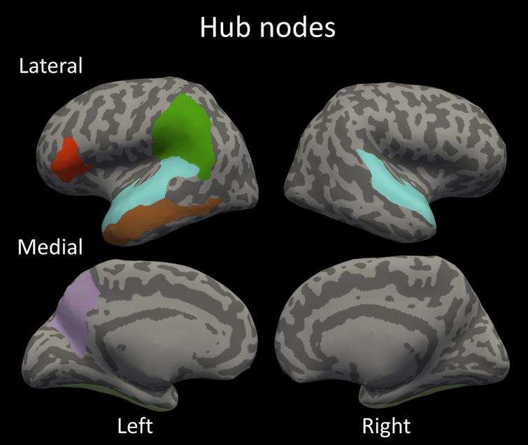 The identified hub nodes in the structural covariance network; bilateral fusiform gyrus; bilateral superior temporal gyrus; left supramarginal gyrus; left opercular part of inferior frontal gyrus; left precuneus and left middle temporal gyrus.