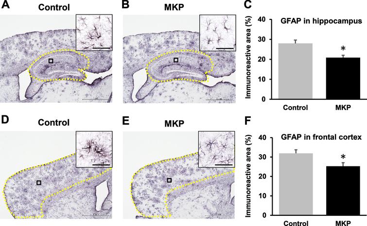GFAP-immunoreactivity in APP/PS1 mice after Met-Lys-Pro (MKP) p.o. administration. Free-floating brain sections in the sagittal plane immunostained with GFAP antibodies for activated astrocytes in the hippocampus (A, B, and C) and frontal cortex (D, E, and F). Immunohistochemistry images of control (A) and MKP (B) in the hippocampus. Percentage of immunoreactive areas in each group in the hippocampus (C). Immunohistochemistry images of control (D) and MKP (E) in the frontal cortex. Percentage of the immunoreactive area in each group in the frontal cortex (F). Scale bar: 1 mm. To calculate GFAP-immunoreactive area (C and F), the areas outlined in yellow (A, B, D, and E) were normalized. High-magnification images revealed single astroglial cell morphology in the cortex and hippocampus of the APP/PS1 mice (A, B, D, and E). Scale bars: 20μm (insets). Data represent mean±SEM. Data were analyzed using the Student’s t-test. *p < 0.05 compared to Control. (Control, n = 19; MKP, n = 19).