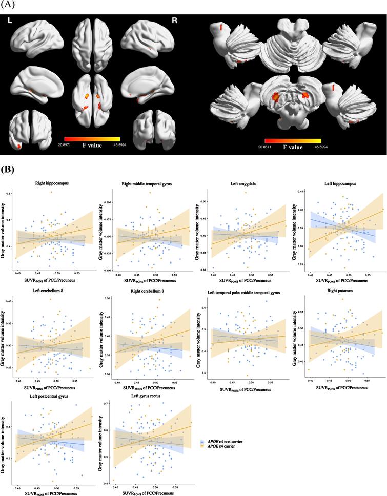 A) Brain regions showing a significant interaction between Aβ deposition in the posterior cingulate cortex/precuneus and APOE ɛ4 carrier status on gray matter volume in cognitively normal older adults with sub-threshold Aβ deposition. B) Scatter plots visualizing relationships between sub-threshold Aβ deposition in the posterior cingulate cortex/precuneus and gray matter volume in regions of interest according to APOE ɛ4 carrier status. General linear model analysis adjusting for age, sex, years of education, and total intracranial volume, FDR-adjusted p < 0.001, cluster p < 0.05. The cluster size of the regions of interest was greater than 100 voxels. SUVRPONS, standardized uptake value ratio of [18F] flutemetamol.