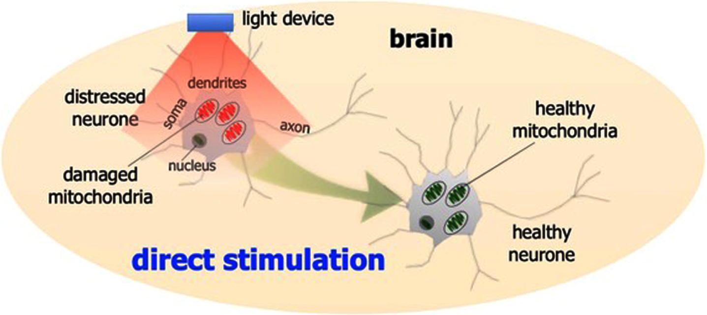 Schematic diagram outlining the direct photobiomodulation stimulation. Photobiomodulation stimulates the mitochondria to produce more energy. This process leads to a healthier cell, with the expression of various functional and protective genes that make the cell not only function better, but make it more resistant to distress and disease.