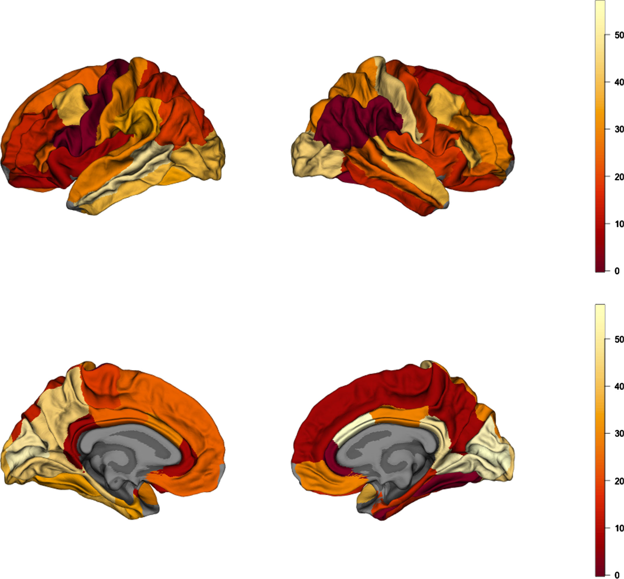 Brain map of absolute values of rank differences between AD and obesity cortical-thickness maps. Lower values represent higher rank similarity of the parcels, depicting regions of highest similarity between AD and obesity.