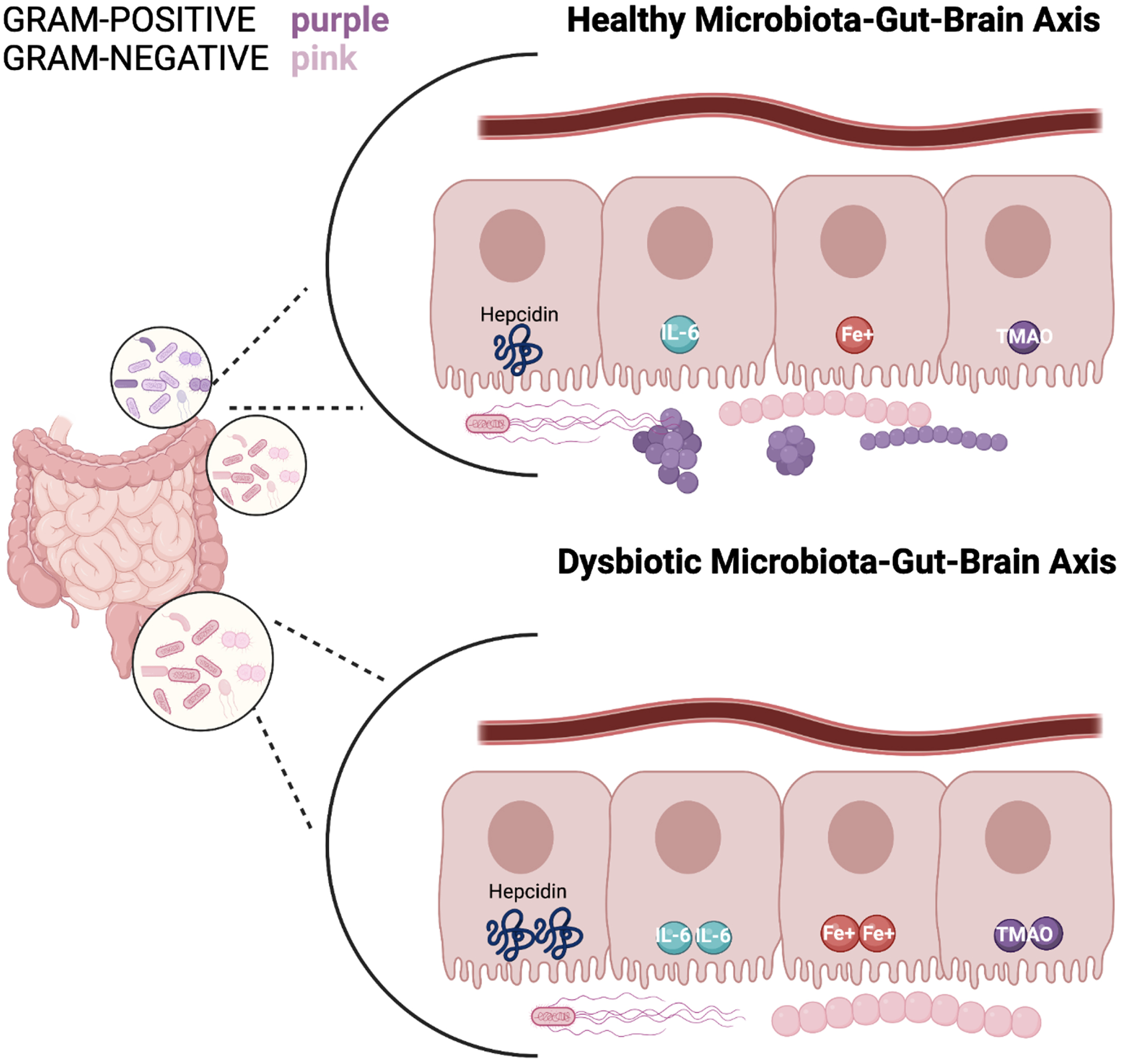 A healthy microbiota consists of a balance of Gram-positive and Gram-negative bacteria; in which hepcidin, iron (Fe3+), IL-6, and TMAO levels express a normal state of balance. Whereas a dysbiosis state indicates an increase of gram-negative bacteria and elevated hepcidin levels resulting in excessive iron accumulation. This stimulates high ferritin levels which promotes less cognitive decline and therefore excess hepcidin production. The synthesis of hepcidin is rapidly increased by infection and inflammation in which elevated IL-6 levels initiate a pro-inflammatory cascade. With IL-6 upregulation occurring in the liver, the higher levels of TMA become oxidized to TMAO. Circulation of TMAO initiated in the small intestine initiates an inflammatory state.