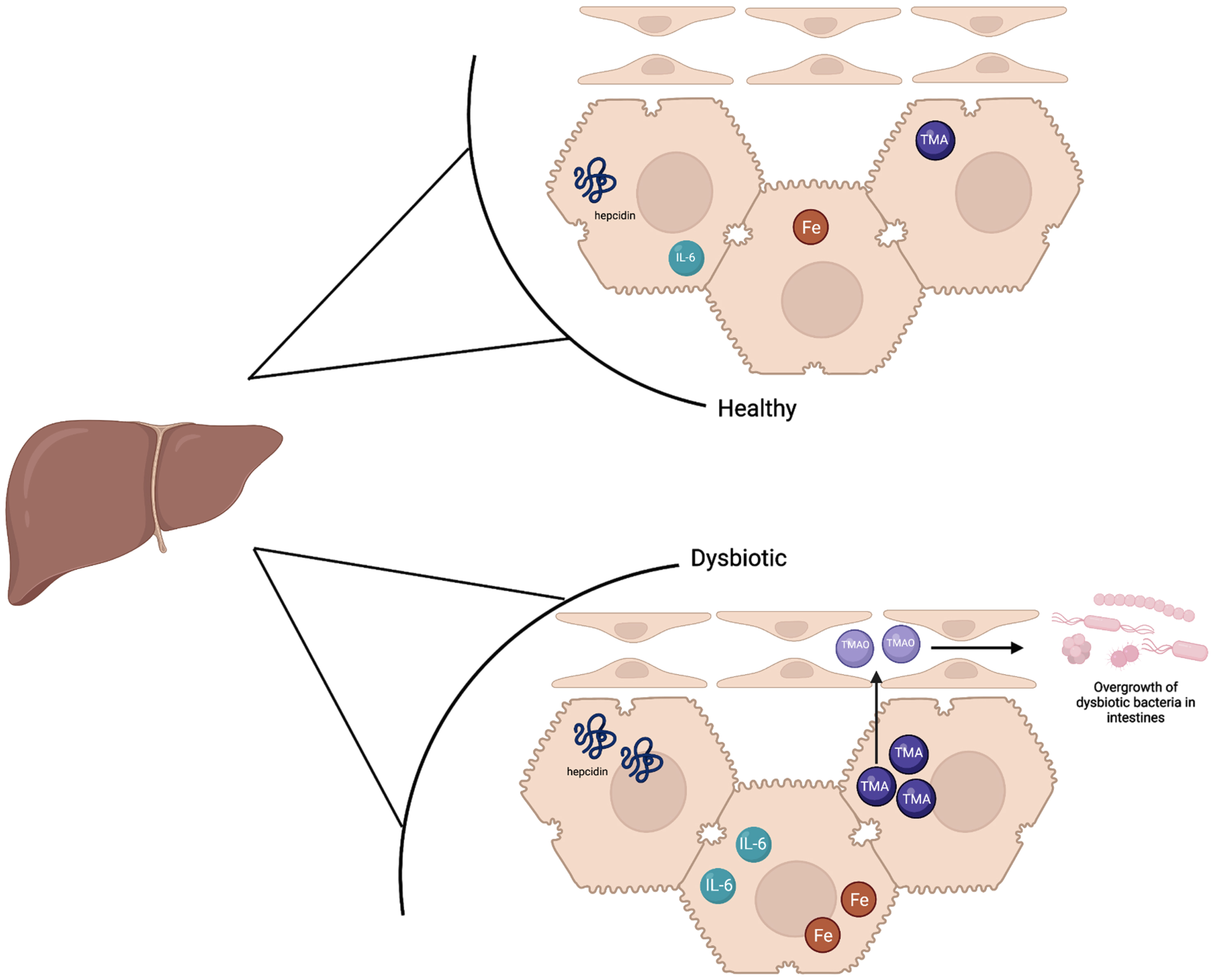 The liver in a healthy state contains baseline hepcidin, IL-6, and TMA levels which supports a balance of healthy and dysbiotic bacteria. Iron levels are slightly higher in the healthy state than a dysbiotic state as hepcidin is upregulated in a dysbiotic state. In the dysbiotic state, IL-6 is also upregulated in the liver, and higher levels of TMA are sent to the liver to be oxidized to TMAO. TMAO is sent to the small intestines which ultimately causes inflammation and the overgrowth of dysbiotic bacteria.