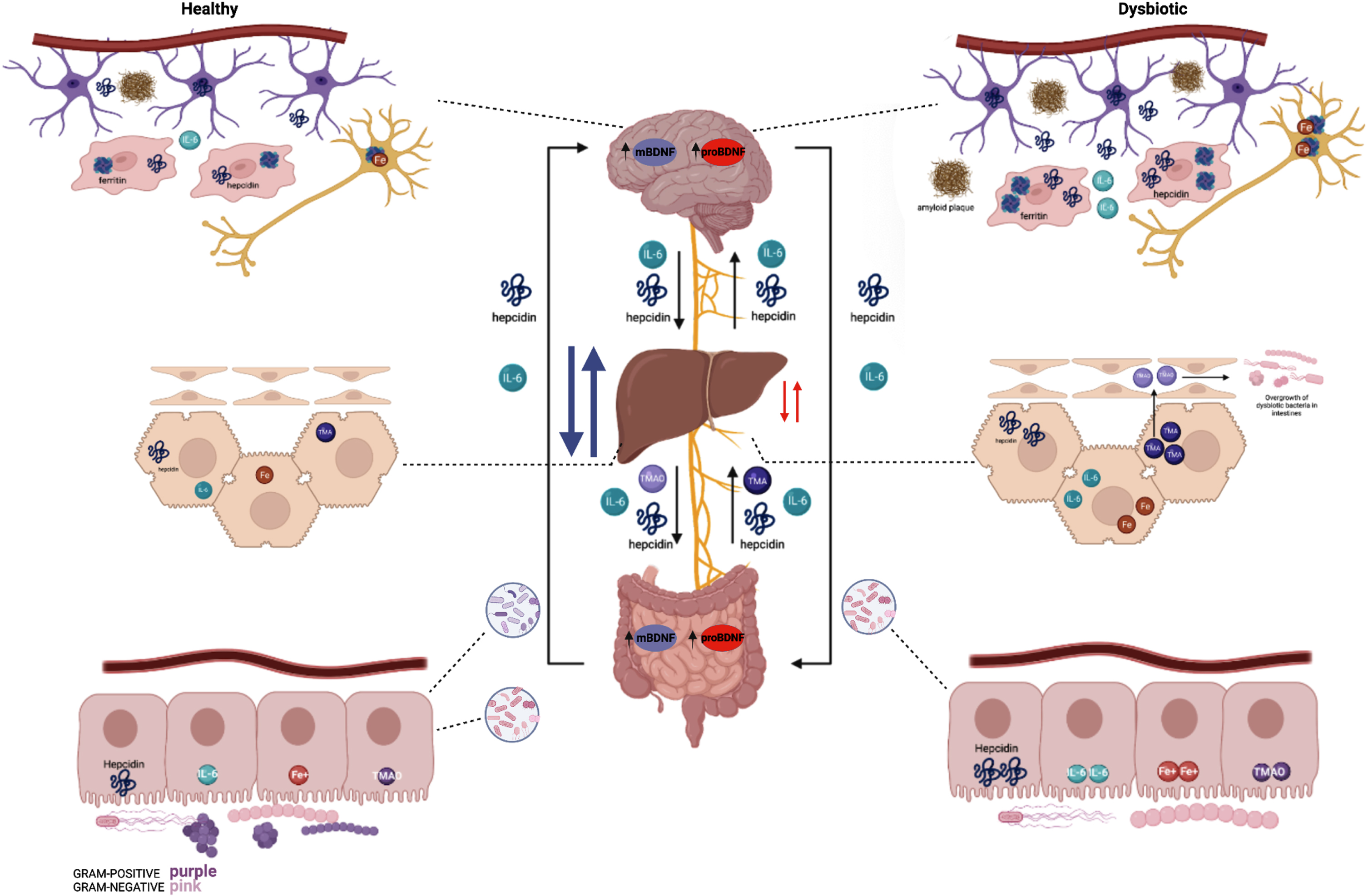 Summary of healthy (left) and dysbiotic (right) states of the gut-brain axis. The left region of the figure depicts the brain, liver, and gut at optimal health whereas the right region represents the brain, liver, and gut in dysbiotic states. The brain, in a state of a healthy microbiota, ferritin, hepcidin, IL-6, and iron are all at baseline levels. The liver in a healthy state contains baseline hepcidin, IL-6, and TMA levels which supports a balance of healthy and dysbiotic bacteria. Iron levels are slightly higher in the healthy state than a dysbiotic state as hepcidin is upregulated in a dysbiotic state. In addition, a healthy microbiota consists of a balance of Gram-positive and Gram-negative bacteria; in which hepcidin, iron (Fe3+), IL-6, and TMAO levels express a normal state of balance. The right region of the figure depicts the brain in a state of dysbiotic microbiota. The brain responds preventatively by upregulating ferritin and hepcidin levels, as well as IL-6. This is done via the astrocytes (purple) and microglia (red). In the neuron (dark yellow), iron is upregulated as well in the setting of neuroinflammation. Amyloid plaques can also be seen in the dysbiotic state as above. Below, the liver is illustrated in a state of dysbiosis. IL-6 is upregulated, and higher levels of TMA are sent to the liver to be oxidized to TMAO. TMAO is sent to the small intestines which ultimately causes inflammation and the overgrowth of dysbiotic bacteria. Most importantly, the dysbiotic microbiota indicates an increase of gram-negative bacteria and elevated hepcidin. Whereas a dysbiosis state indicates an increase of gram-negative bacteria and elevated hepcidin levels resulting in excessive iron accumulation. This stimulates high ferritin levels which promotes less cognitive decline and therefore excess hepcidin production. The synthesis of hepcidin is rapidly increased by infection and inflammation in which elevated IL-6 levels initiate a pro-inflammatory cascade. With IL-6 upregulation occurring in the liver, the higher levels of TMA become oxidized to TMAO. Circulation of TMAO initiated in the small intestine initiates an inflammatory state.