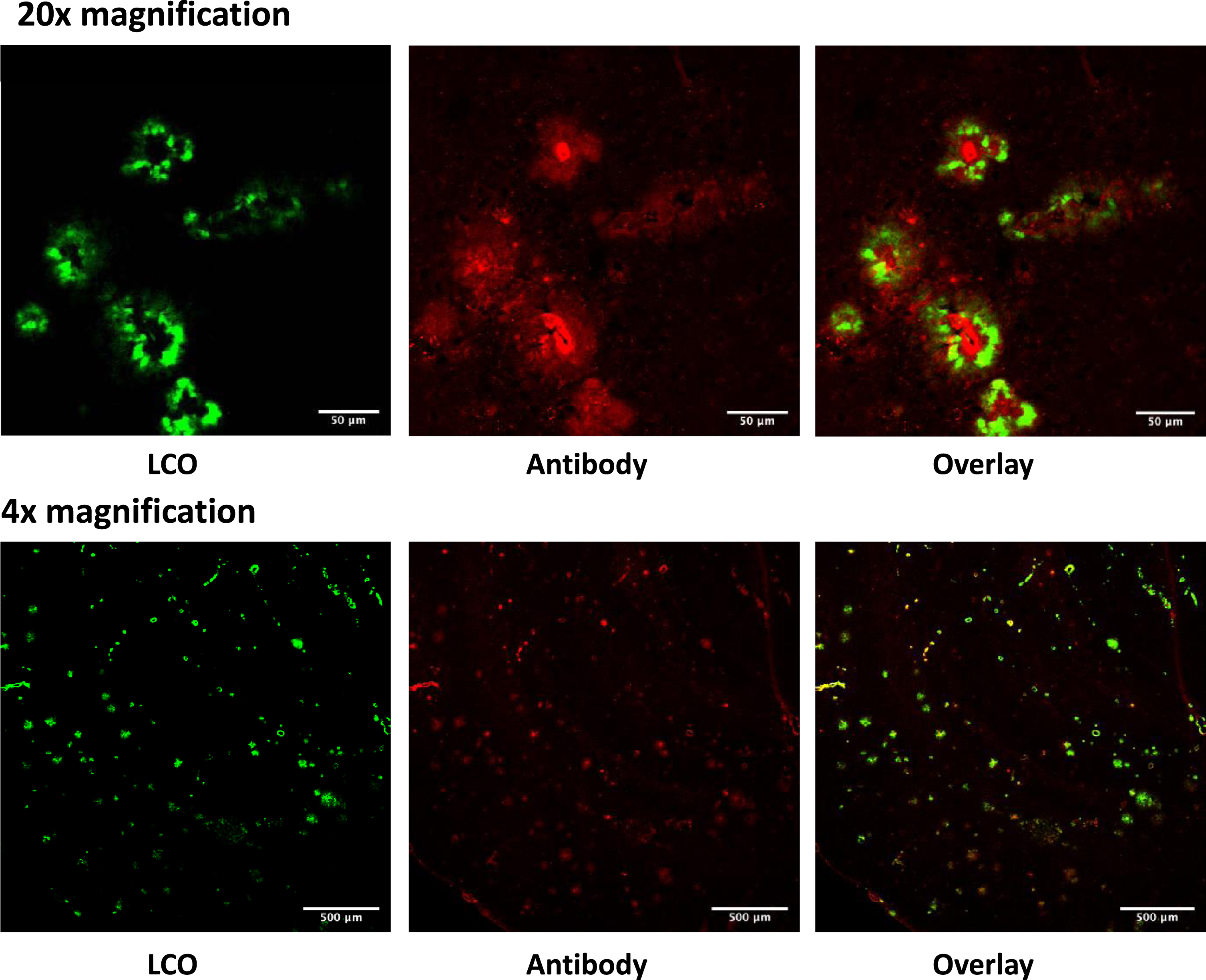 Sections from the brain of 28 months old TgAPPSwe mice labelled in vivo with LCO-DOTA (green) and stained with an anti-amyloid plaque (4G8) antibody (red). The images show that the two stains label the same objects albeit at different binding sites.