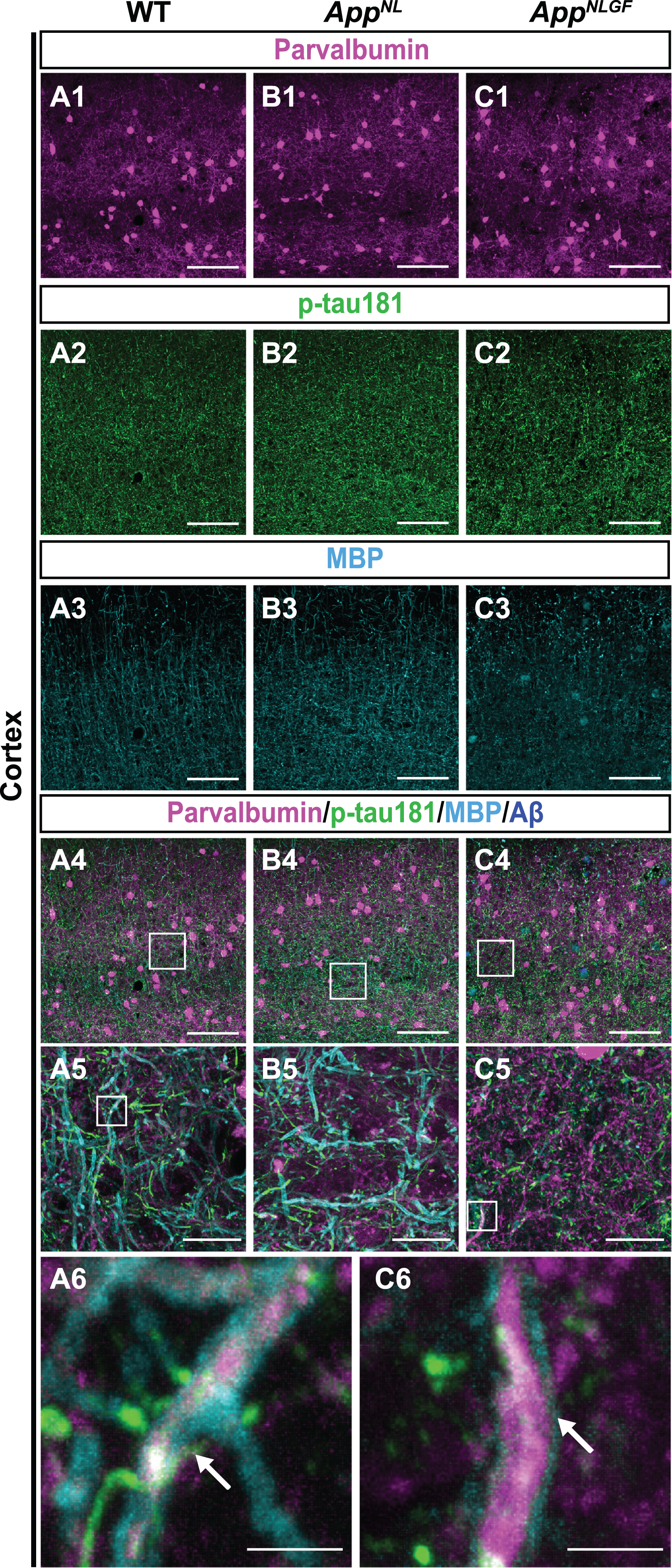 p-tau181-positive axons overlap with parvalbumin-expressing axons in mouse brains. (A1– C4) Representative images of the cortex from frozen coronal brain sections immunostained with antibodies against parvalbumin (magenta), p-tau181 (green), and MBP (cyan). FSB was used for detecting Aβ plaques (blue). Scale bars, 100μm. (A5– C5) Higher magnification of framed regions indicated in A4– C4. Scale bars, 20μm. (A6, C6) Higher magnification of framed regions indicated in A5 and C5. White arrows indicate MBP signals enwrapped with the p-tau181-positive axons of parvalbumin-expressing interneurons. Scale bars, 2.5μm.