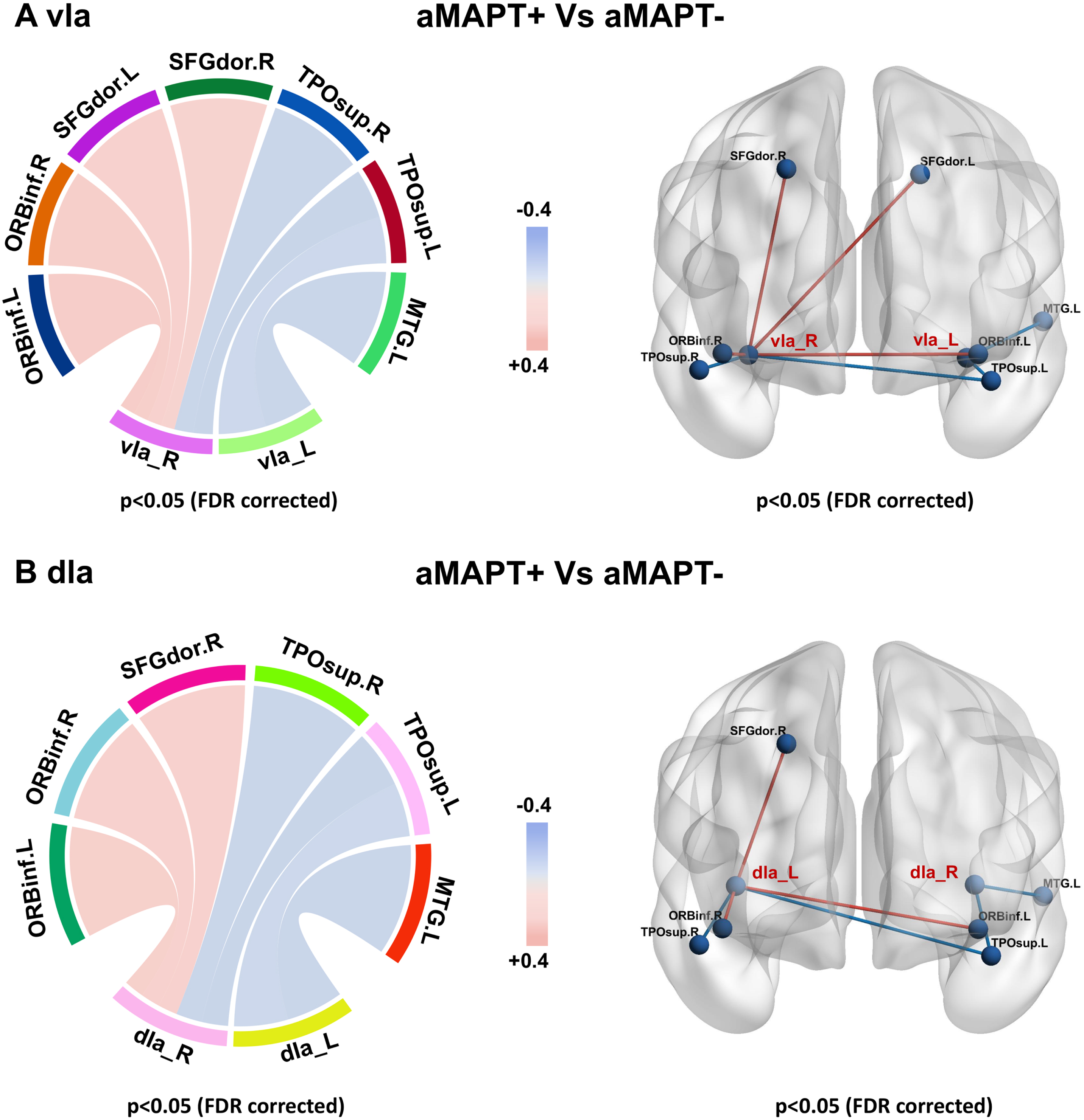 Sub-insula metabolic network in aMAPT+ and aMAPT– groups. In the comparison of the sub-insula metabolic network between aMAPT+ and aMAPT– subjects, the left vIa showed weakened connections with left medial temporal gyrus and left superior temporal pole, whereas the right vIa showed weakened connections with bilateral superior temporal pole and enhanced connectivity with bilateral dorsolateral superior frontal gyrus and bilateral inferior orbital frontal gyrus (A). Additionally, the left dIa showed weakened connections with the left middle temporal gyrus and left superior temporal pole, whereas the right dIa showed weaken connections with bilateral superior temporal pole and enhanced connectivity with the right dorsolateral superior frontal gyrus and bilateral inferior orbital frontal gyrus (B).