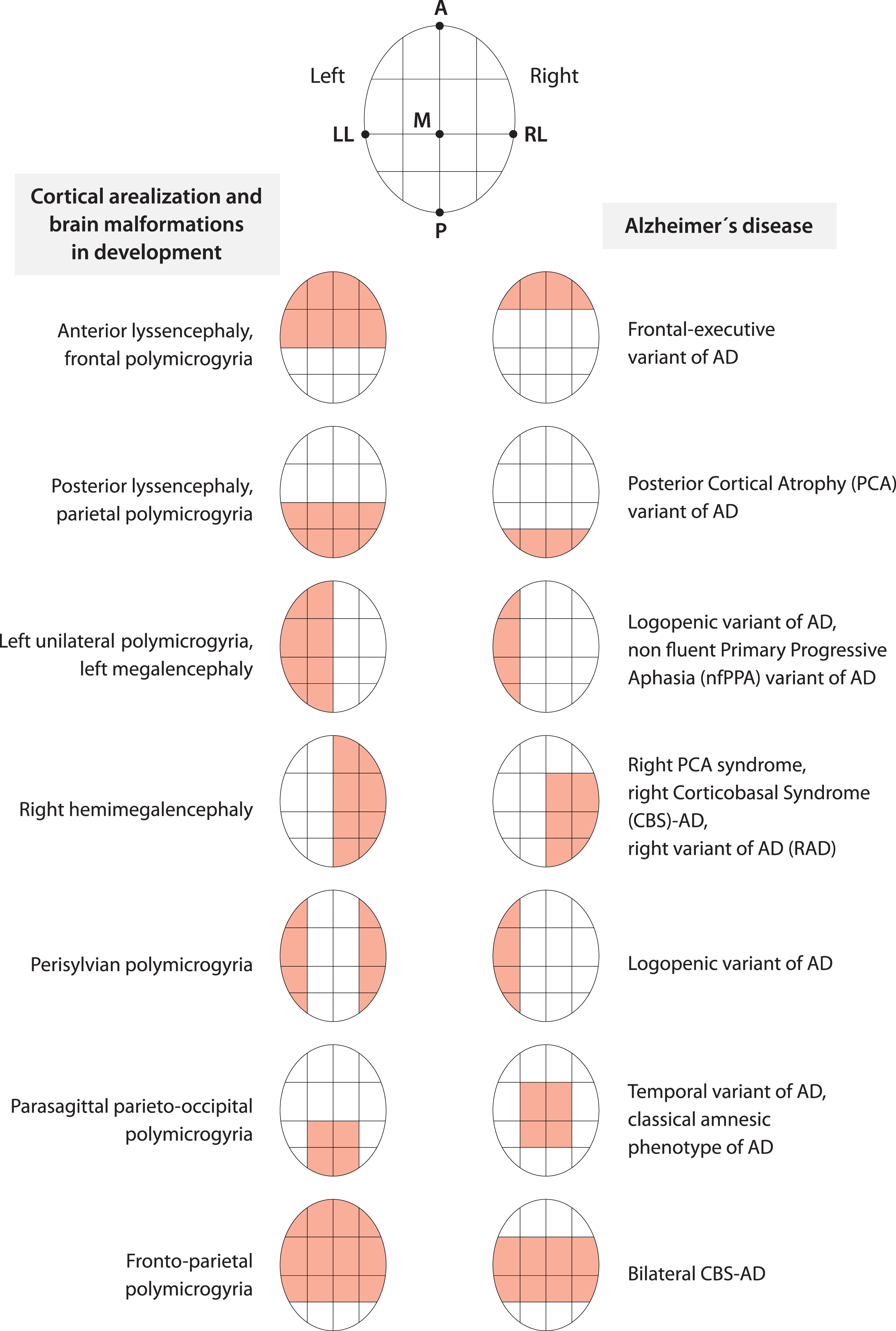 Cortical arealization in development and AD appear to share the same alphabet of spatial information about brain topography. The coarse distribution over the cortex of brain malformations due to the failure of the arealization program during development and the key regions targeted by AD, considering all phenotypes, seem to follow the same few topographical instructions related to anterior-posterior, medial-lateral, dorsal-ventral brain axes and a simple left-right hemisphere specification. Figure 3 was produced by Antonio Garcia, scientific illustrator from Bio-Graphics. This is a modified version of Fig. 1 in Abbate (2018) [366].
