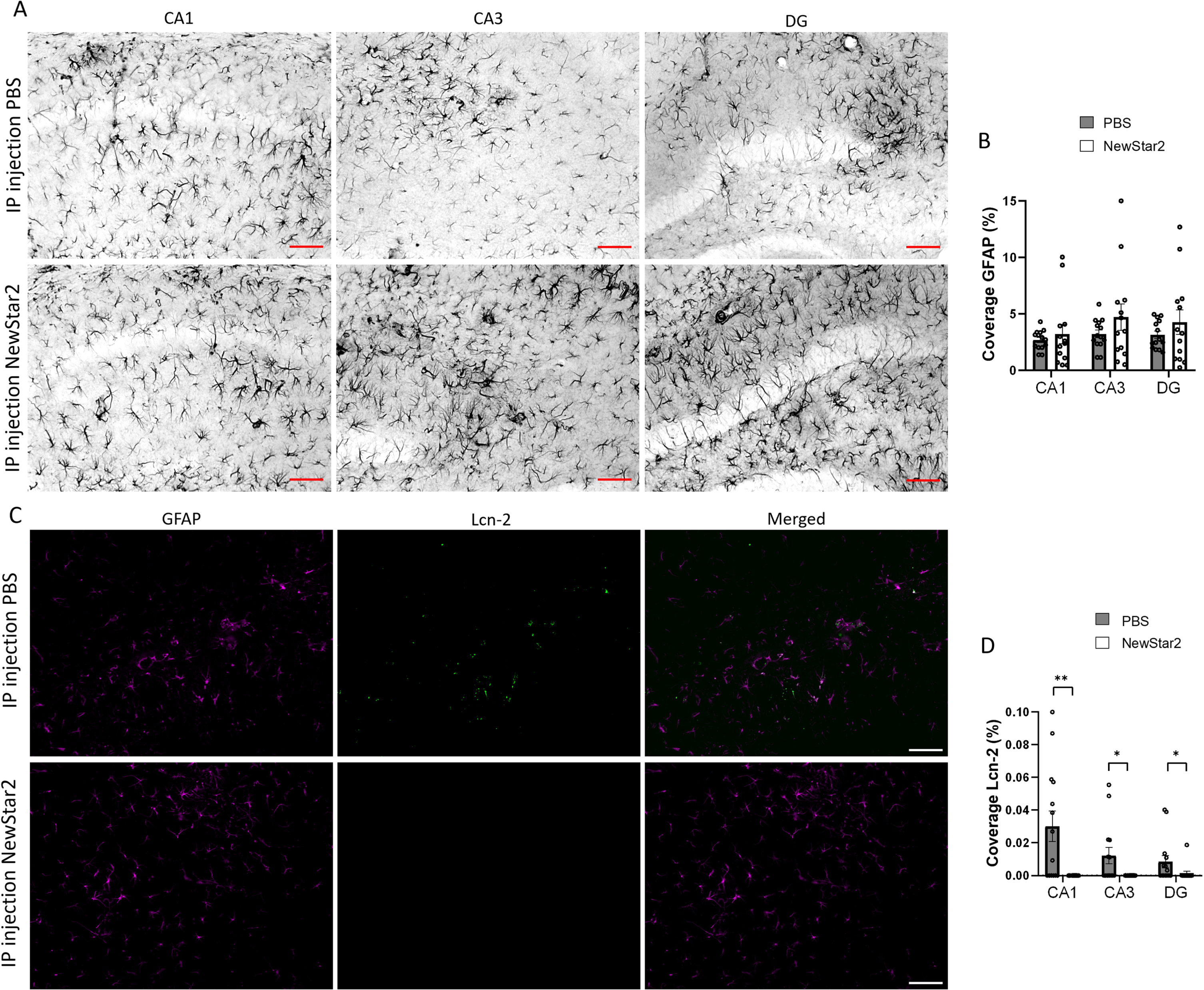 NewStar2 administration contributes to decreasing Lcn-2 expression levels. A) Representative images of activated astrocytes (GFAP) in CA1, CA3, and DG areas after PBS or NewStar2 administration (Scale bar, 100μm). B) Quantification of GFAP coverage in CA1 (p = 0.55), CA3 (p = 0.21), and DG (p = 0.30) hippocampal areas (PBS, n = 14; NewStar2, n = 14, unpaired t-test). C) Sections were stained with anti-GFAP (magenta) for activated astrocytes and anti-Lcn-2 (green). Representative images of the CA1 area are shown (Scale bar, 100μm). D) Quantification of Lcn-2 coverage in CA1 (p = 0.0019), CA3 (p = 0.015), and DG (p = 0.025) hippocampal areas (PBS, n = 14; NewStar2, n = 14, unpaired t-test). Data are presented as mean±SEM. *p < 0.05; **p < 0.01.