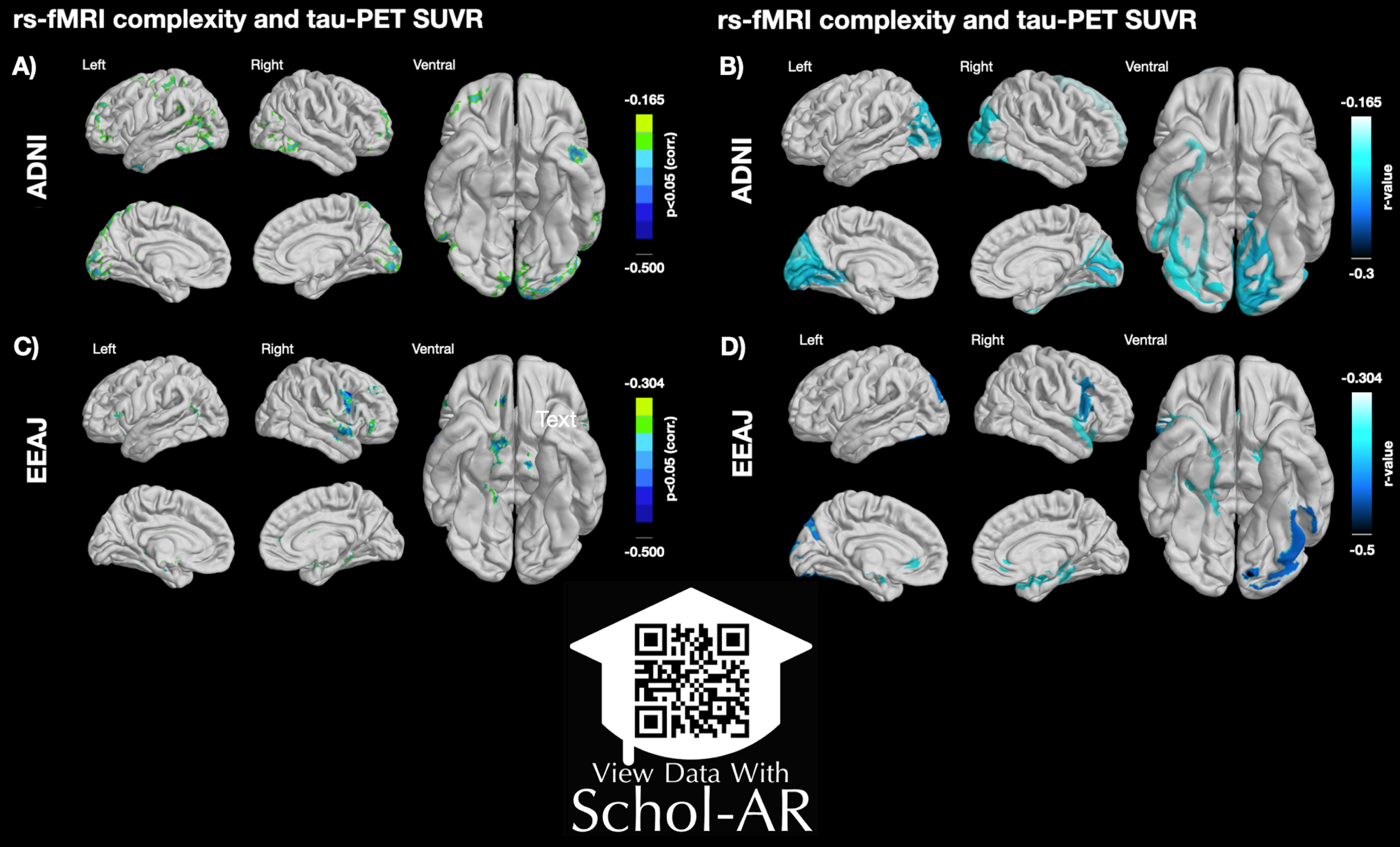 Left panel: Voxel-wise associations between rs-fMRI complexity and tau-PET SUVR in ADNI (A) and EEAJ (C) cohorts. Right panel: AAL atlas regional associations between rs-fMRI complexity and tau-PET SUVR in ADNI (B) and EEAJ (D) cohorts. AAL, automated anatomical labeling atlas. ScholAR QR code will enable augmented reality 3D visualization of the results displayed in the left panel using the Schol-AR app or opening manuscript pdf in https://www.schol-ar.io/reader. A citation for Schol-AR: Ard T, Bienkowski MS, Liew S-L, Sepehrband F, Yan L, Toga AW, Integrating Data Directly into Publications with Augmented Reality and Web-Based Technologies - Schol-AR (2022) Scientific Data 9: 298. https://www.nature.com/articles/s41597-022-01426-y