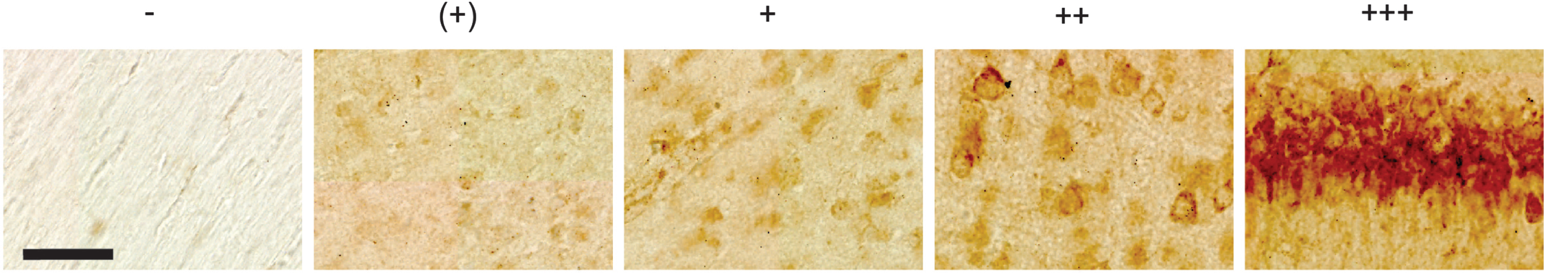 Representative examples of levels of Aβ42 as placed into five different categories, including none (denoted -), minimal levels (denoted +), low-to-moderate levels (denoted +), moderate-to-high levels (denoted ++), and high levels (denoted +++). These examples are taken from a 12-month-old animal. Scale bar = 50μm.