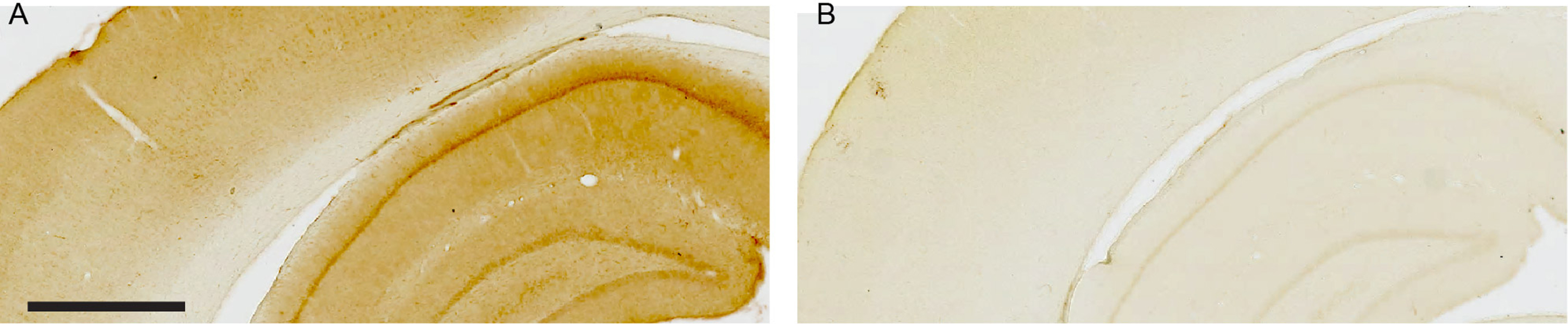Omission of the anti-Aβ42 primary antibody demonstrates lack of background labeling. A) Part of neocortex and the dorsal hippocampus after three-day incubation with anti-Aβ42 primary antibody followed by visualization with 3,3’-Diaminobenzidine as the chromogen (see Methods for details). B) Adjacent section undergoing identical treatment but where the anti-Aβ42 primary antibody was omitted. Sections are from an 18-month-old Wistar rat. Scale bar: (A) = 1000μm as also applies to (B).
