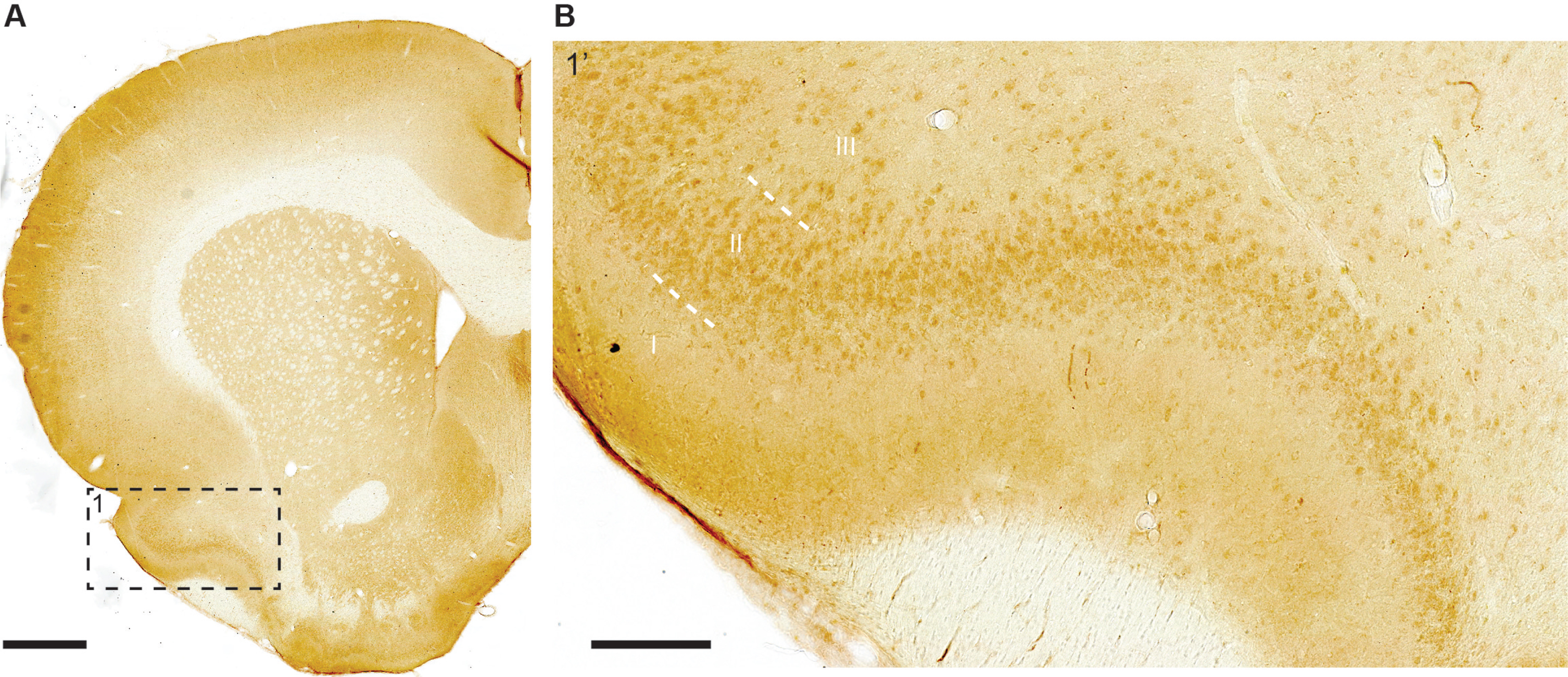 Moderate-to-high levels of iAβ42, mainly leaning towards moderate, are present in layer II neurons of the piriform cortex. A far lesser number of layer III neurons also stain positive for iAβ42. A) Frontal section with example of piriform cortex indicated (1, dashed rectangle), along with (B) higher-powered inset. Note that aside from the signal in neurons, an Aβ42-positive band of labelling is present in the outer half of layer I. Scale bars: (A) 1000μm, (B) 200μm.