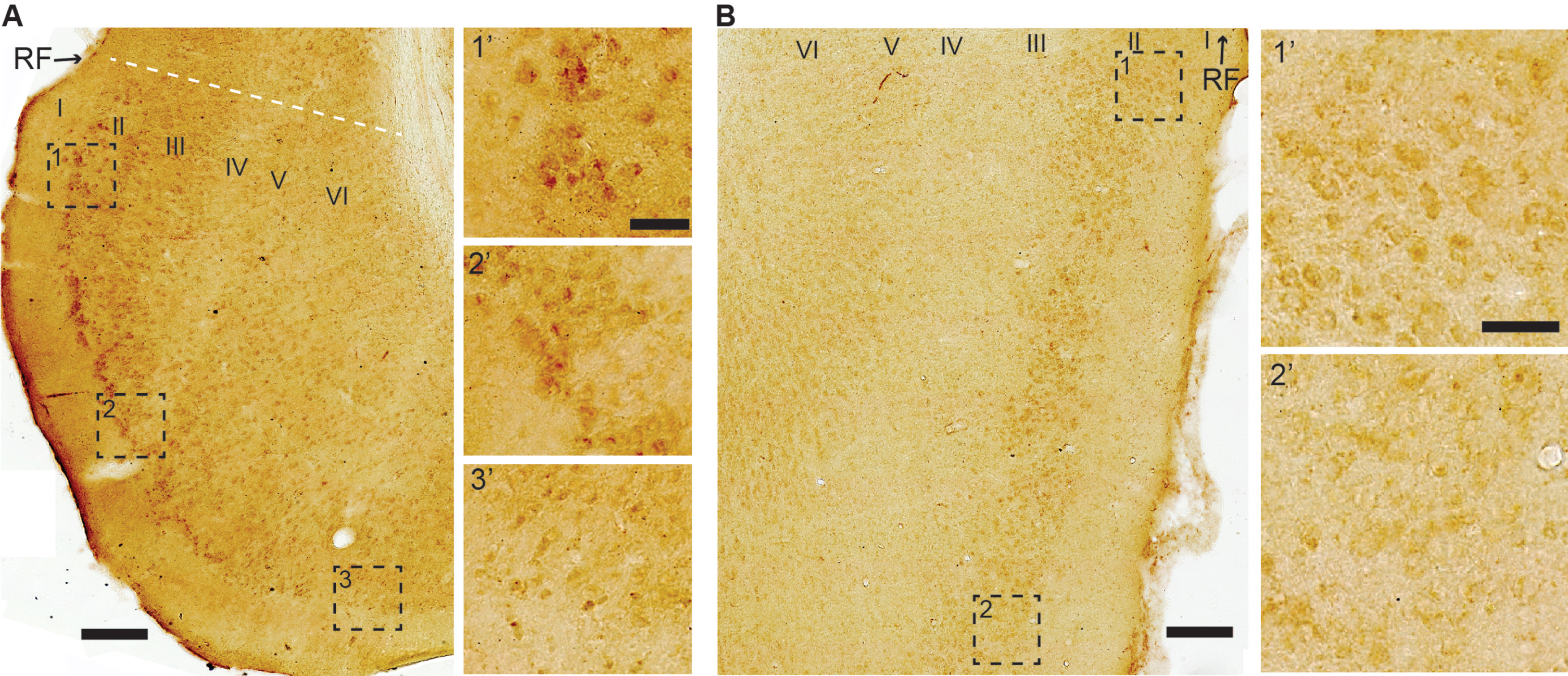 High levels of iAβ42 are present in entorhinal cortex (EC) LII-neurons that are situated close to the rhinal fissure. A) In LEC, high levels of iAβ42 are present in neurons in the outer portion of LII that are close to the rhinal fissure (RF); iAβ42 levels gradually diminish in intensity when moving successively further away from RF, being reduced to low levels at the point furthest away from RF. This feature is similar, though less pronounced, also in the case of LIII, but is not present in deeper layers. B) In MEC, low-to-moderate levels of iAβ42 are present in LII neurons located close to RF, and, similar to that of LEC, iAβ42 levels diminish in intensity when moving successively further away from the rhinal fissure. Layers are indicated (I-VI). Dashed white line in (A) indicates border with perirhinal cortex. Micrographs are from an 18-month-old animal. Scale bars 200 μm and insets 50 μm.