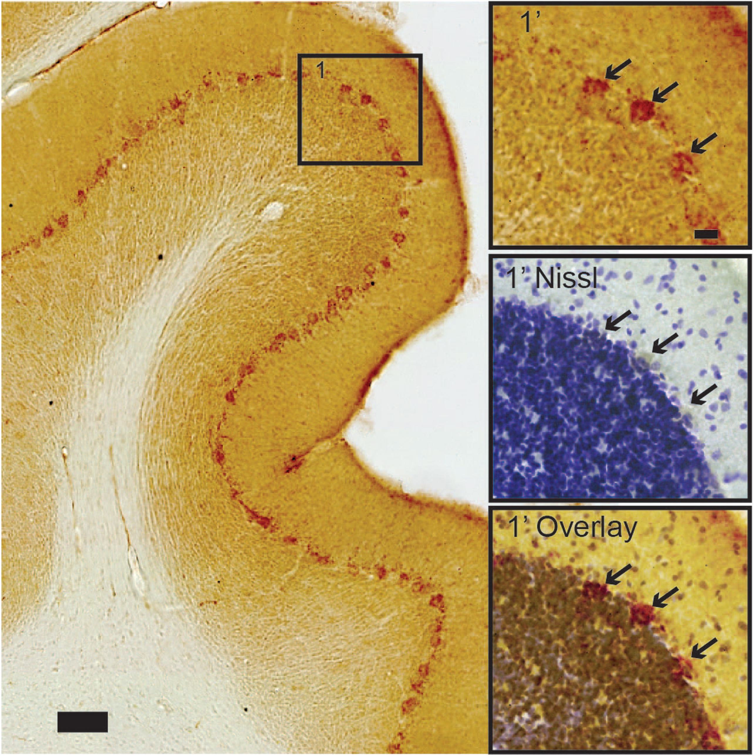 Cerebellar Purkinje neurons contain high levels of iAβ42, in stark contrast to surrounding neurons. Insets show arrows pointing to (top) iAβ42-positive Purkinje neurons, followed by (middle) the position of these neurons after Nissl counterstain on the same section, and (bottom) a contrast enhanced overlay of the top and middle insets. Scale bars: 100μm (large image) and insets 20μm.