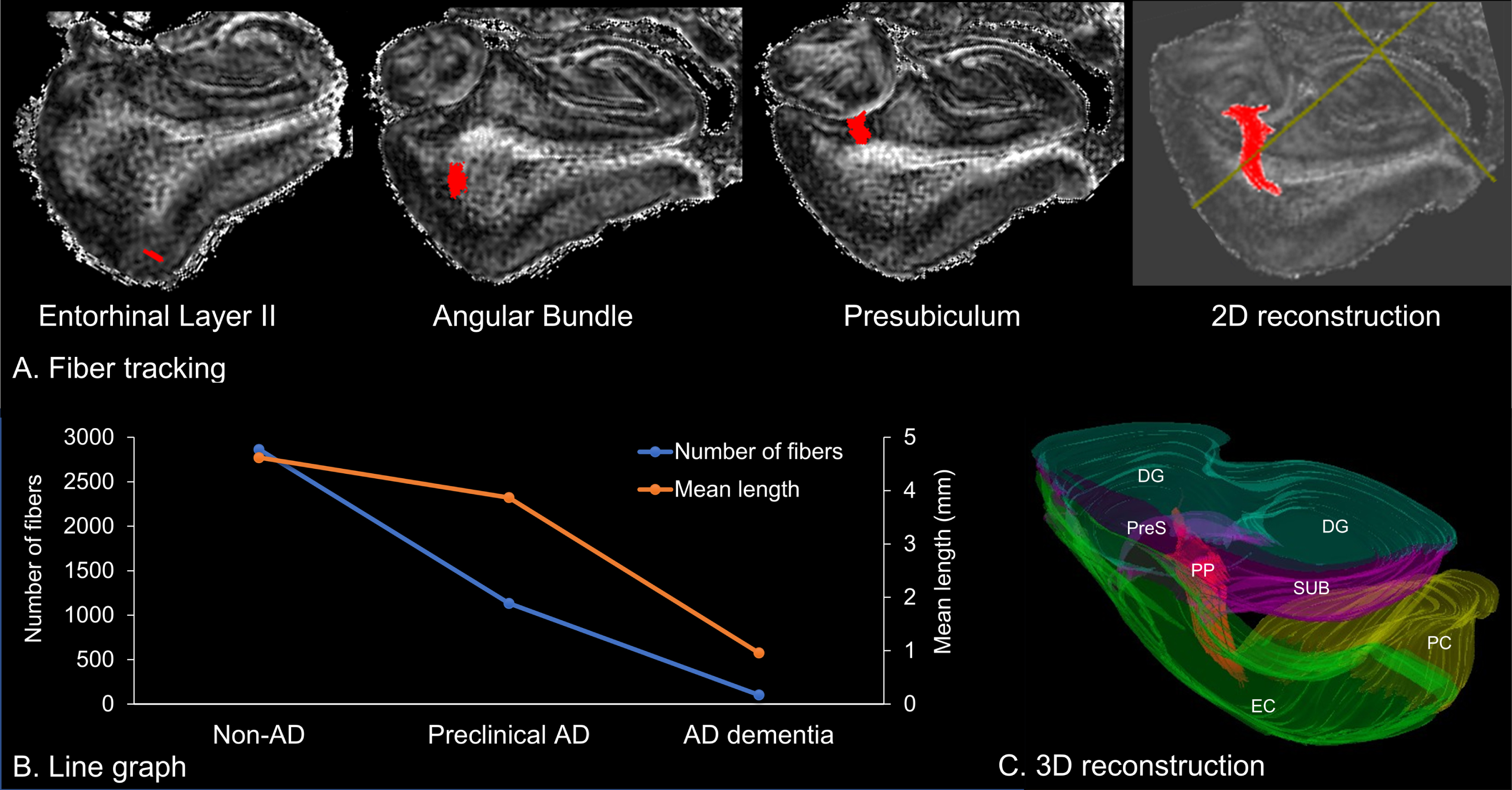 Fiber tractography of the perforant pathway. A) Two-dimensional (2D) reconstruction of the perforant pathway, which originates from the entorhinal layer II and projects to the hippocampus through the angular bundle and the presubiculum. B) Line graph of the number and mean length of fibers. C) Three-dimensional (3D) reconstruction of fibers to the surrounding anatomical structures. DG, dentate gyrus; EC, entorhinal cortex; PC perirhinal cortex; PP, perforant pathway; PreS, presubiculum; SUB, subiculum.