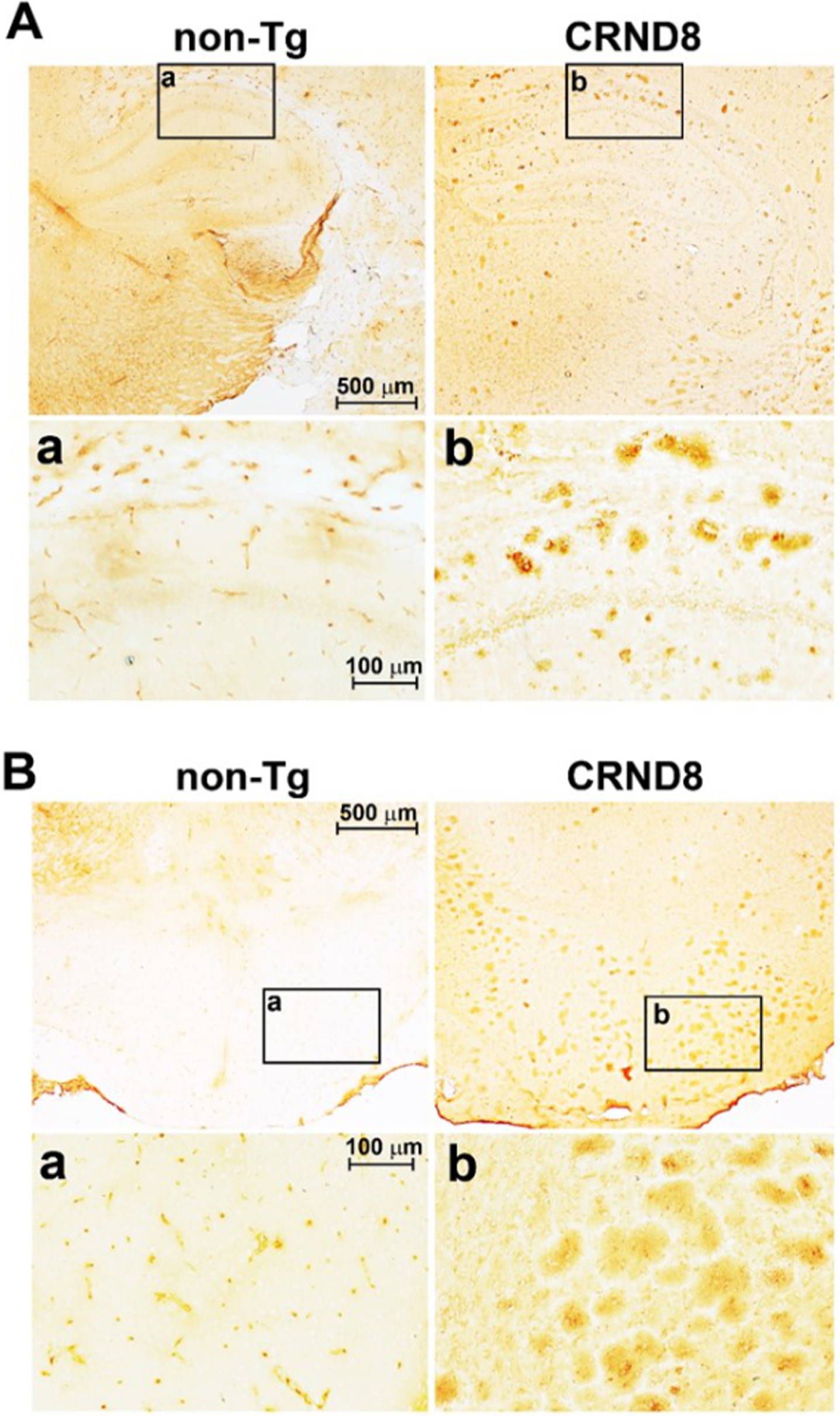 Aβ plaques were clearly visible in the brain of CRND8 mice. Representative histological sections of CRND8 and non-Tg brains stained with 6E10 antibody. In A, Aβ plaques were visible throughout the brain of CRND8 but not non-Tg mice, with a) and b) referring to zoomed-in insets of the hippocampus in non-Tg and CRND8 mice, respectively. In B, brain slices containing the hypothalamus were imaged at low magnification, with a) and b) referring to zoomed-in insets of the hypothalamus in non-Tg and CRND8 mice, respectively.