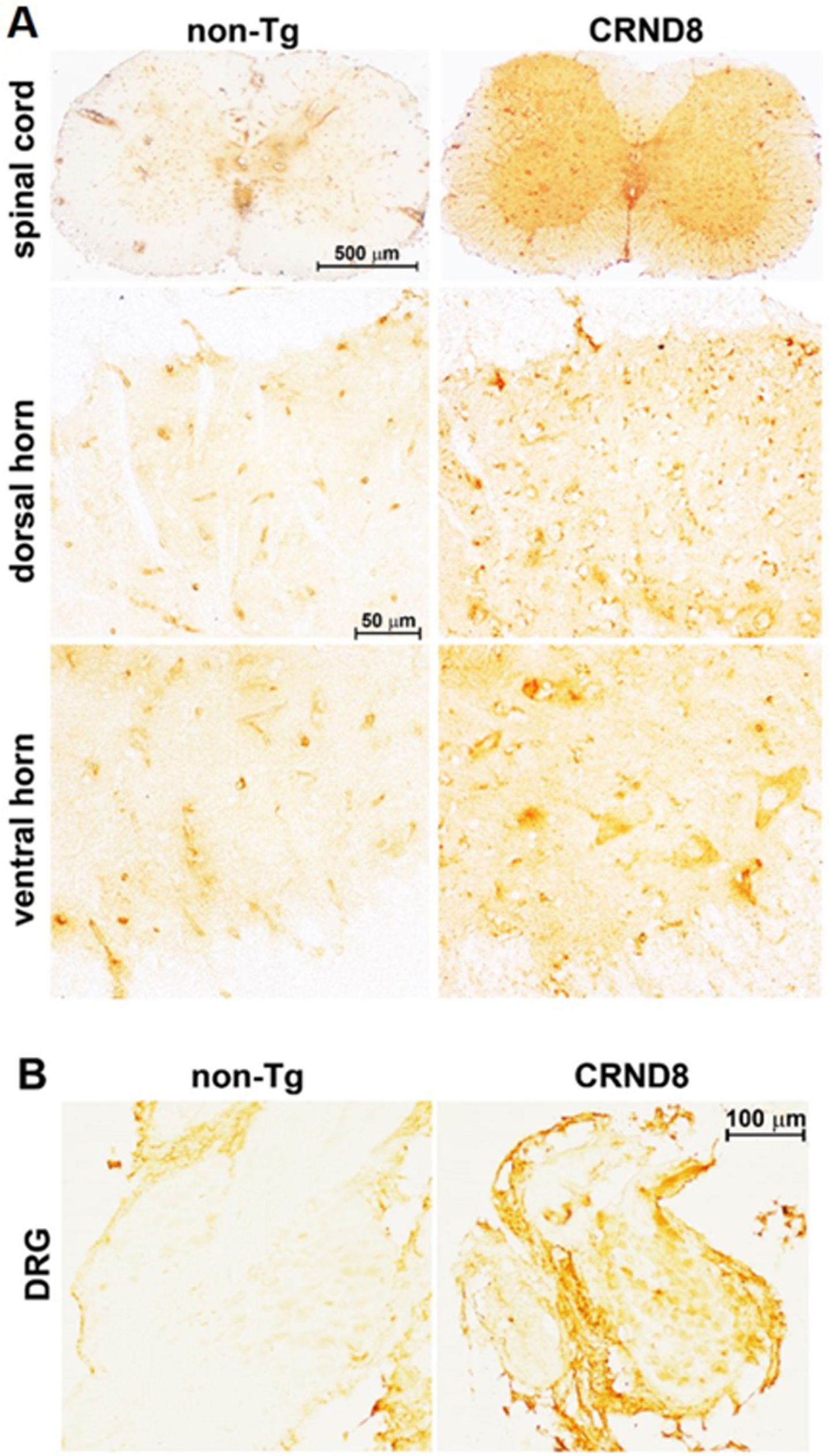 Cellular AβPP/Aβ was visible in the spinal cord and in the DRG of CRND8 mice. Representative AβPP/Aβ immunostaining of CRND8 and non-Tg lumbar spinal cord (A) and DRG (B) sections. AβPP/Aβ immunostaining, by 6E10 antibody, profiled cell bodies in the dorsal horns, in the ventral horns and in the DRG of CRND8 mice. Aβ plaques were not found.