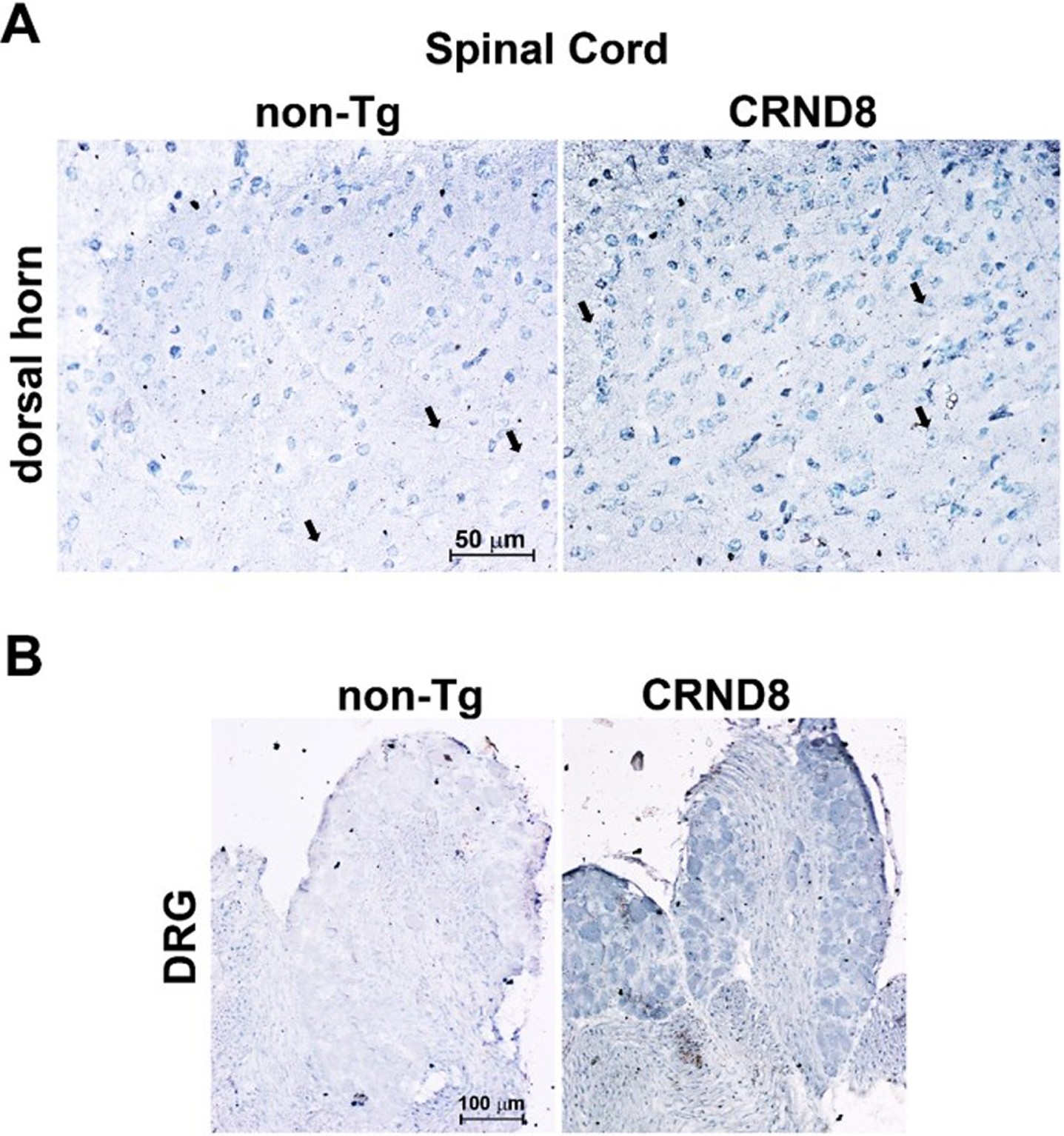 Cellular Aβ40 was visible in the lumbar dorsal horns and in the DRG of CRND8 mice. Representative Aβ40 immunostaining of cell bodies in CRND8 and non-Tg lumbar dorsal horn sections (A). Black arrows indicate large cell bodies that were immunolabeled in CRND8 but not in non-Tg mice (A). In B, representative photomicroscopies of CRND8 and non-Tg DRG sections immunostained for Aβ40. Aβ40 immunostaining was present in CRND8 but not in non-Tg mice.