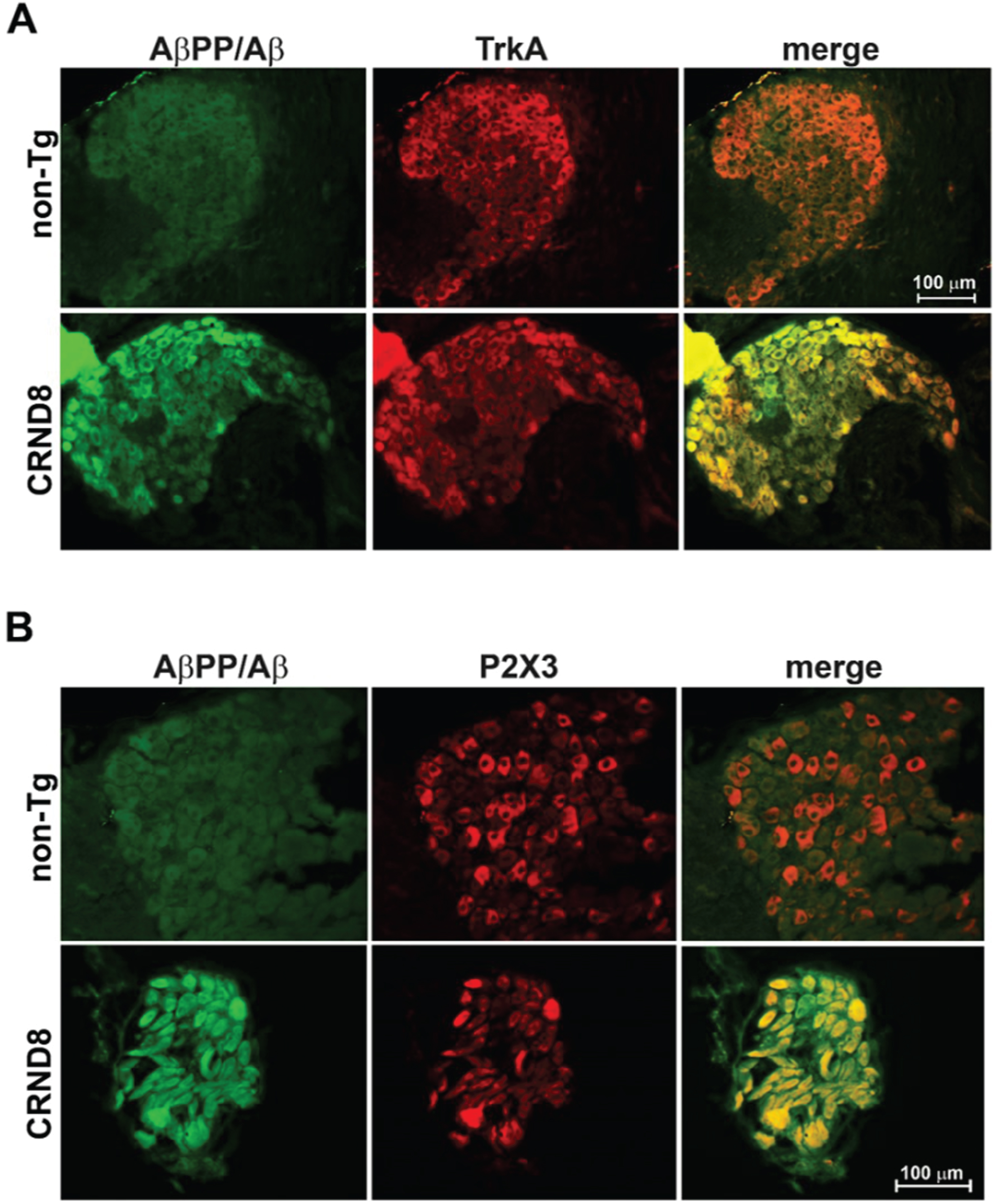 Sensory nociceptive neurons in the DRG of CRND8 mice all expressed AβPP/Aβ. Representative fluorescence images of DRG neurons of CRND8 mice labeled with AβPP/Aβ and either TrkA (A –bottom panel) or P2X3 (B –bottom panel) as markers for peptidergic and non-peptidergic nociceptors, respectively. Representative fluorescence images of DRG neurons of non-Tg mice labeled with AβPP/Aβ and either TrkA (A –top panel) or P2X3 (B –top panel) are shown for comparison.