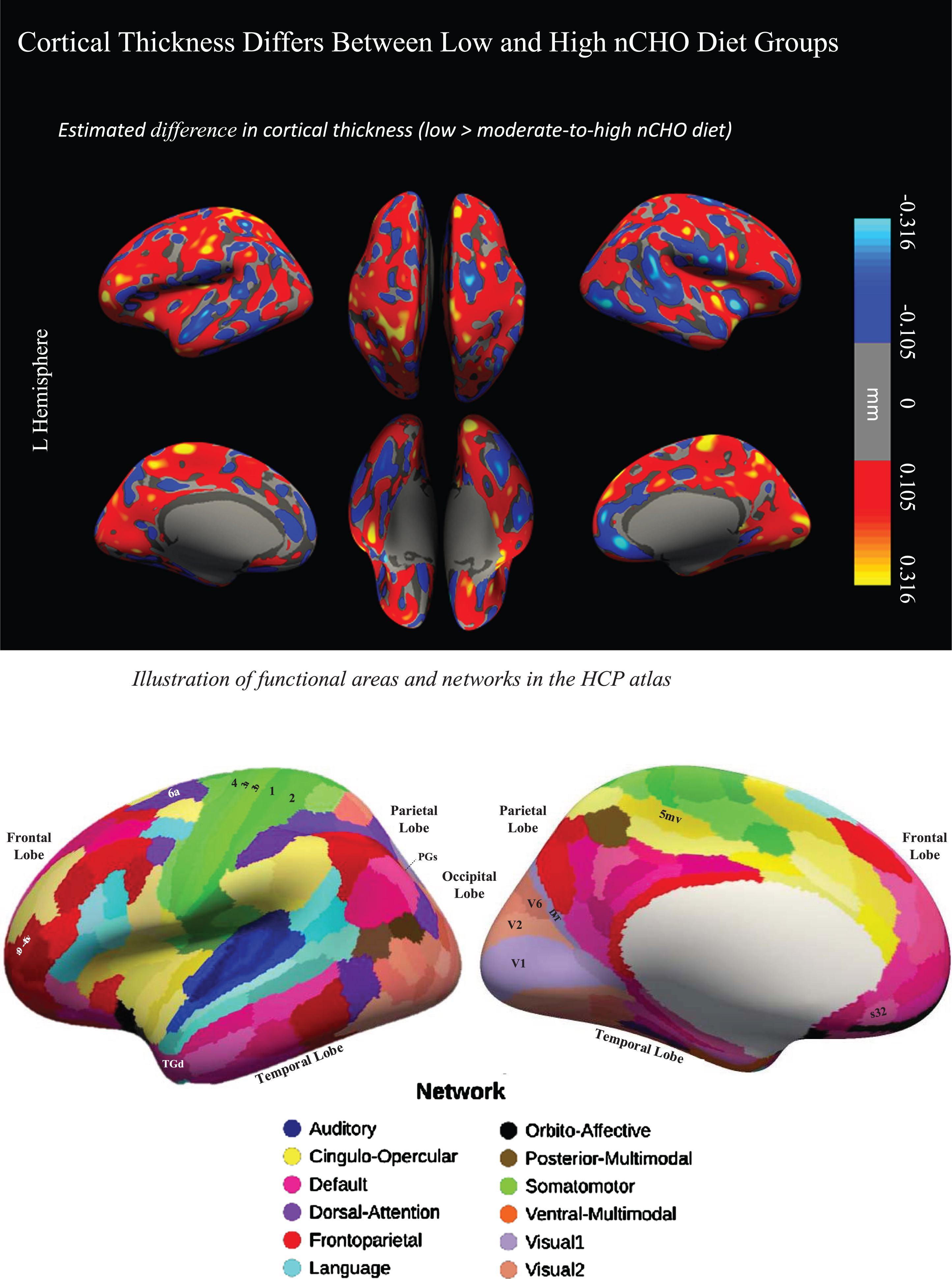 Difference in cortical thickness between lower –higher nCHO diet groups and anatomical reference. Top of figure shows the cortical surface-wide map of the difference in cortical thickness between lower and higher nCHO diet groups. Warmer colors represent voxels with larger thickness in the lower than higher nCHO diet group. Cooler colors represent voxels with larger thickness in the higher than lower nCHO diet group. Bottom of figure shows the Human Connectome Project Multi-Modal Parcellation (HCP-MMP) Atlas.