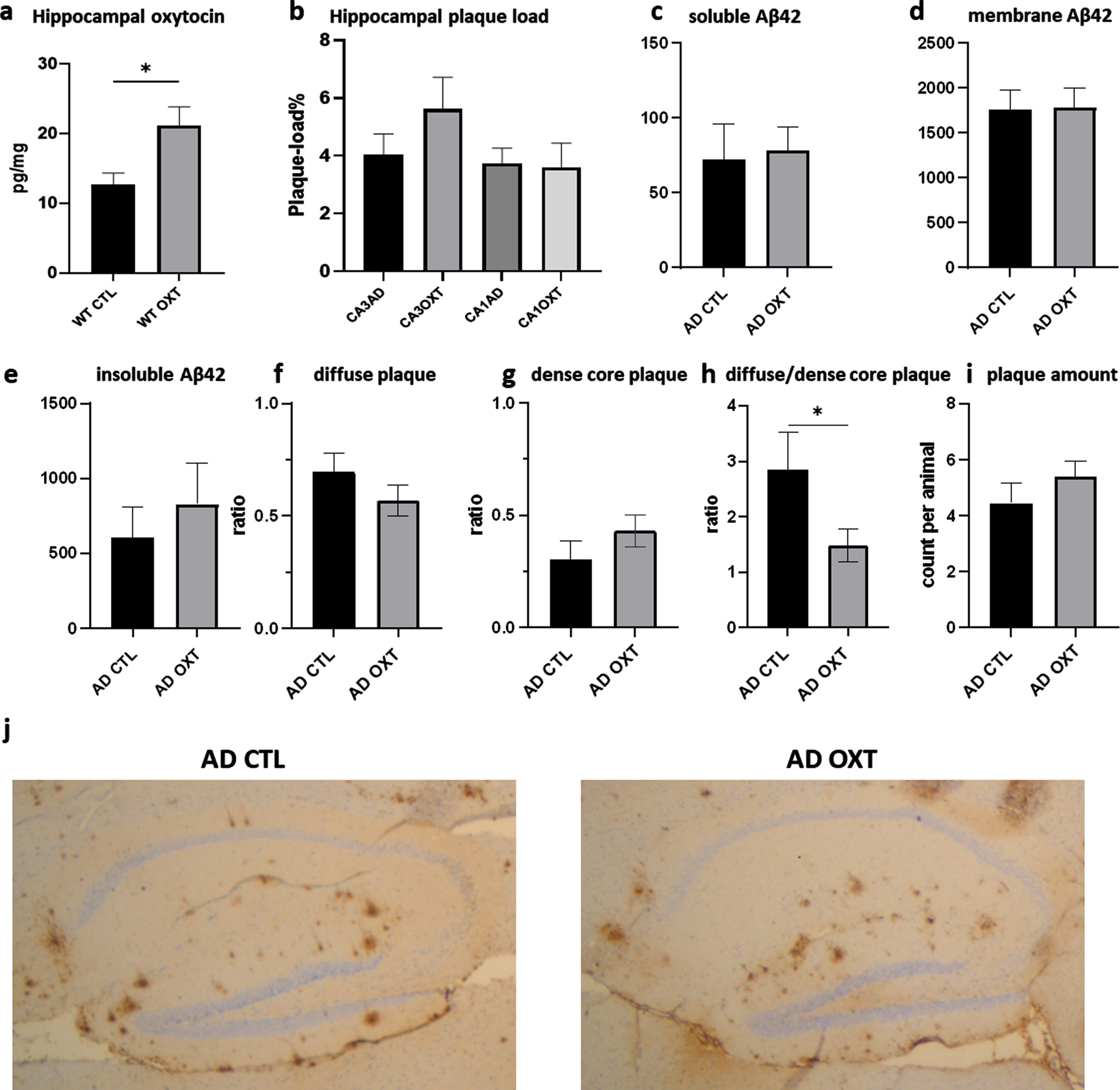 Intranasal administration of oxytocin increases hippocampal oxytocin levels in WT animals (a) does not alter the hippocampal plaque load in APPswePS1dE9 mice treated with oxytocin(b-i). Animals treated with oxytocin show a significant increase of hippocampal oxytocin levels over animals treated with saline (e) (Mann-Whitney test: WT CTL versus WT OXT p = 0.02 n = 8) (a). Aβ plaque load was quantified at 20x magnification in the hippocampus of APPswePS1dE9 mice by immunohistochemically staining Aβ (n = 8). Plaque load was calculated as the percentage of the total hippocampal surface area. Plaque load was not found to be altered within the hippocampus (p = 0.07) after oxytocin administration (Mann-Whitney test) (b). Hippocampal Aβ42 plaque-load by means of an ELISA showed no effect in soluble (c), membrane-associated (d) and insoluble fraction (e) of Aβ42 in AD animals. There was no observable difference in diffuse or dense core plaques or plaque amount between AD CTL and AD OXT (f-g). There are more diffuse plaques compared to dense plaques in AD CTL compared to AD OXT animals (p = 0.04) (h). Representative images of the Aβ-stained hippocampus and cortex for the APPswePS1dE9 control group, the APPswePS1dE9 oxytocin-treated group are shown at 2.5x magnification (j). Bars represent mean±SEM. Aβ, amyloid-β; AD, Alzheimer’s disease; WT, wild type. *p < 0.05.
