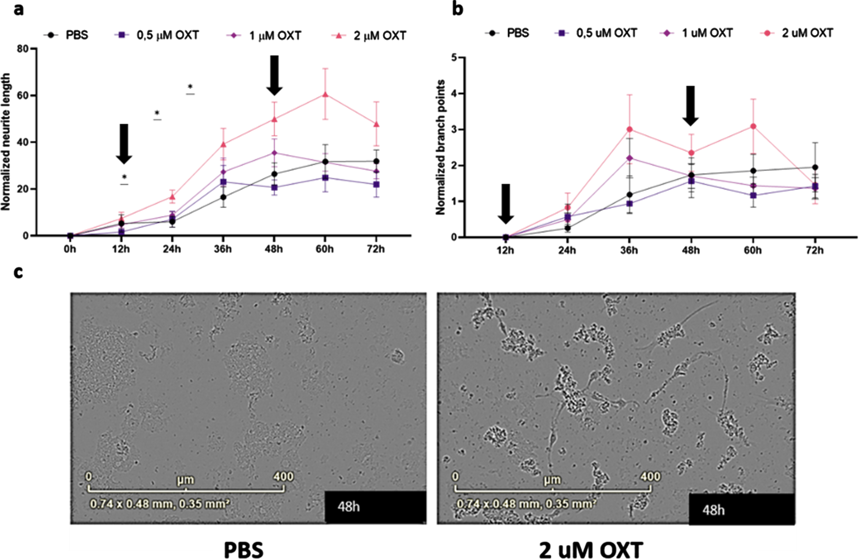 Oxytocin promotes neurite outgrowth, but not branch point formation, in maturing primary rat neurons in vitro. Neurite length per area (a) and the number of branch points per area (b) were evaluated using live-cell imaging. Every 3 h, an analysis was performed. Subsequently, averages were taken per 12 h, which were normalized against the 0 h time point values of the PBS control group (n = 9). In the presence of 2μM oxytocin (n = 9), neurite length was increased from 24 h (p = 0.025) up to 48 h (p = 0.041), after which the beneficial effect gradually diminished. Both incubation time and oxytocin concentration had a significant effect on neurite length. Oxytocin concentrations of 0.5μM (n = 9) and 1μM (n = 9) did not significantly affect neurite length, and neither of the concentrations did increase branch point formation in comparison to the PBS control group. Differentiated HT22 cells do not show increased neurite length when treated with oxytocin regardless of presence or absence of Aβ42. Black arrows indicate initial addition of oxytocin to medium as well as boost after 48 h (a, b). Representative images for primary neurons after 48 h of treatment with 2μM of OXT (left) and PBS (right) (c). One-way ANOVA and Tukey post-hoc analysis. Data points represent mean±SEM. *p < 0.05.