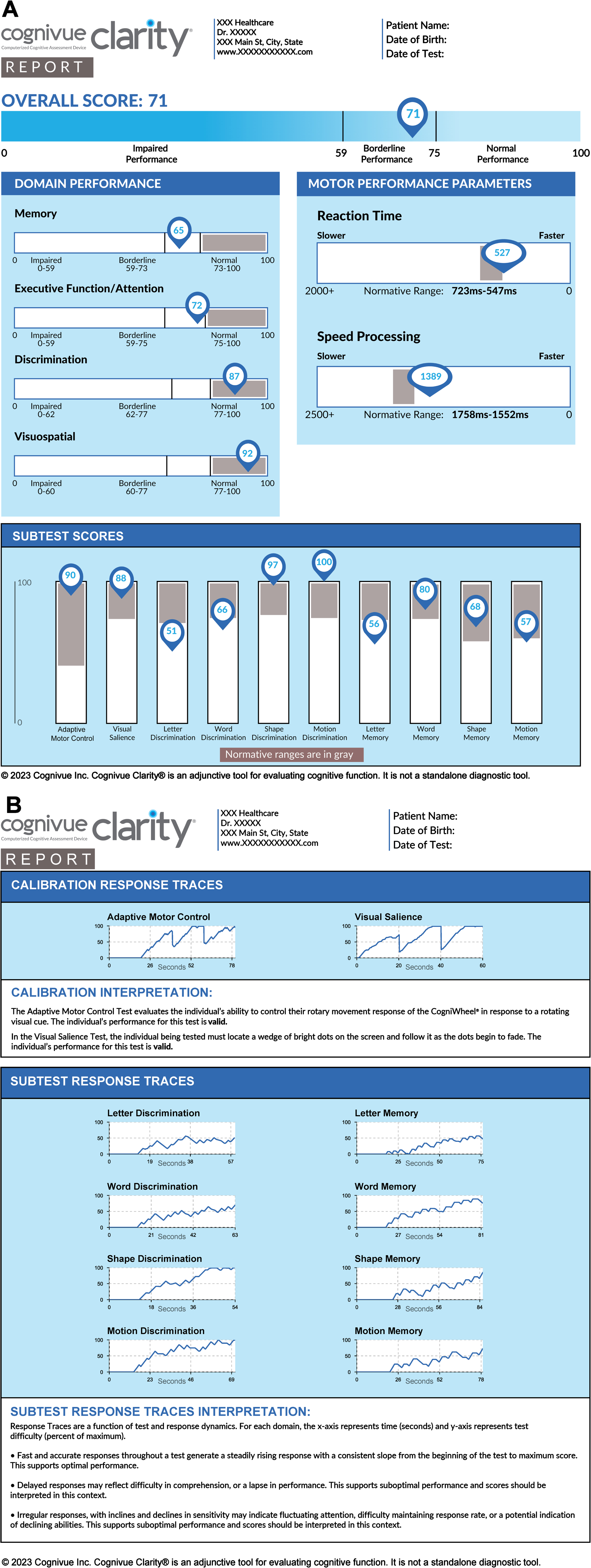 A sample report generated by Cognivue Clarity. Panel A demonstrates the scores derived from Cognivue Clarity including a global performance, 4 domains, 10 subtests, and 2 reaction time measurements. Panel B demonstrates the calibration and subtest response tracings as well as the interpretation of those tracings.