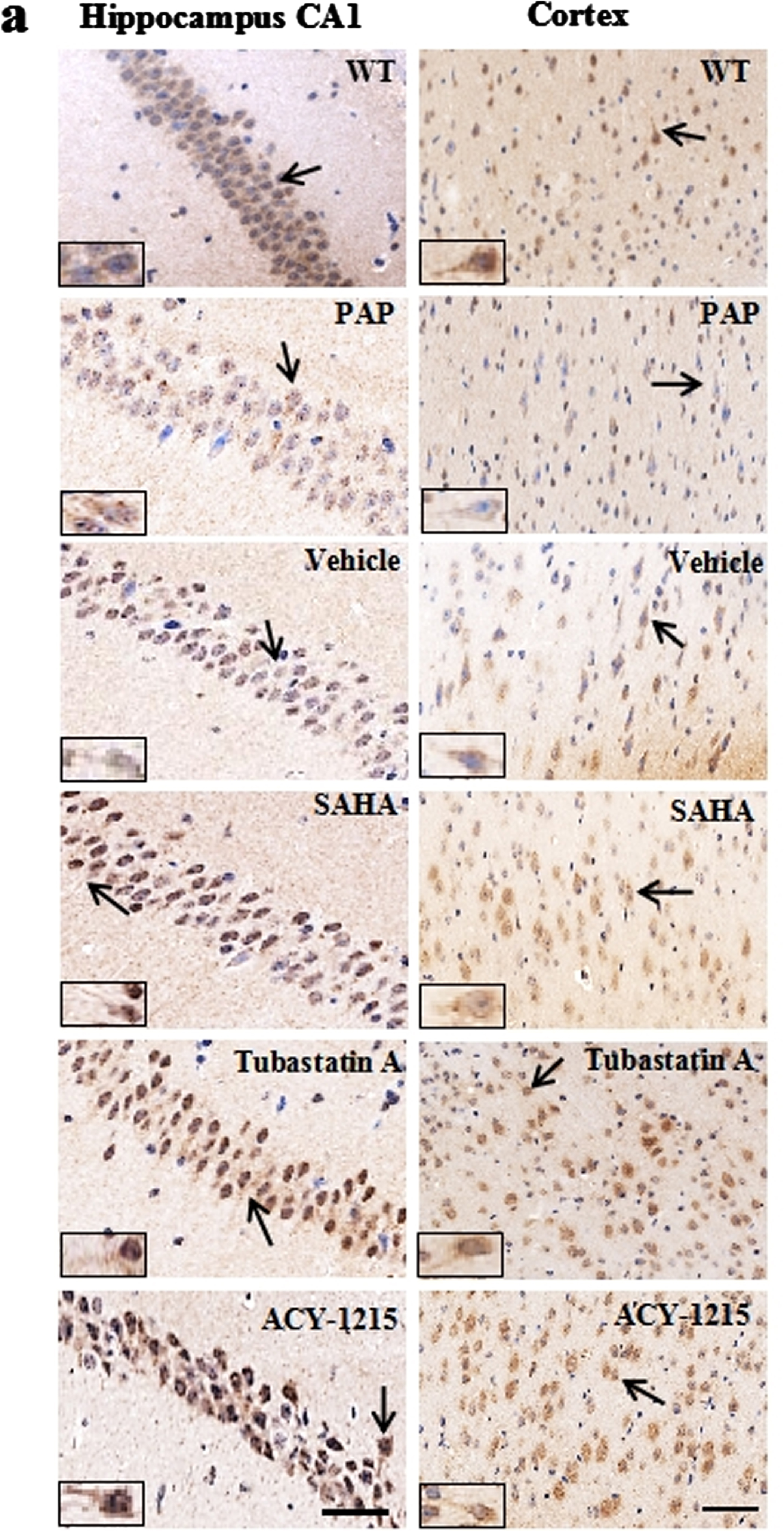 (a). Representative images showing increased immunoreactivity of ace-α-tubulin (K40) in the hippocampus (left) and prefrontal cortex (right) after Tubastatin A or ACY-1215 treatment. Scale bar: 50 μm.