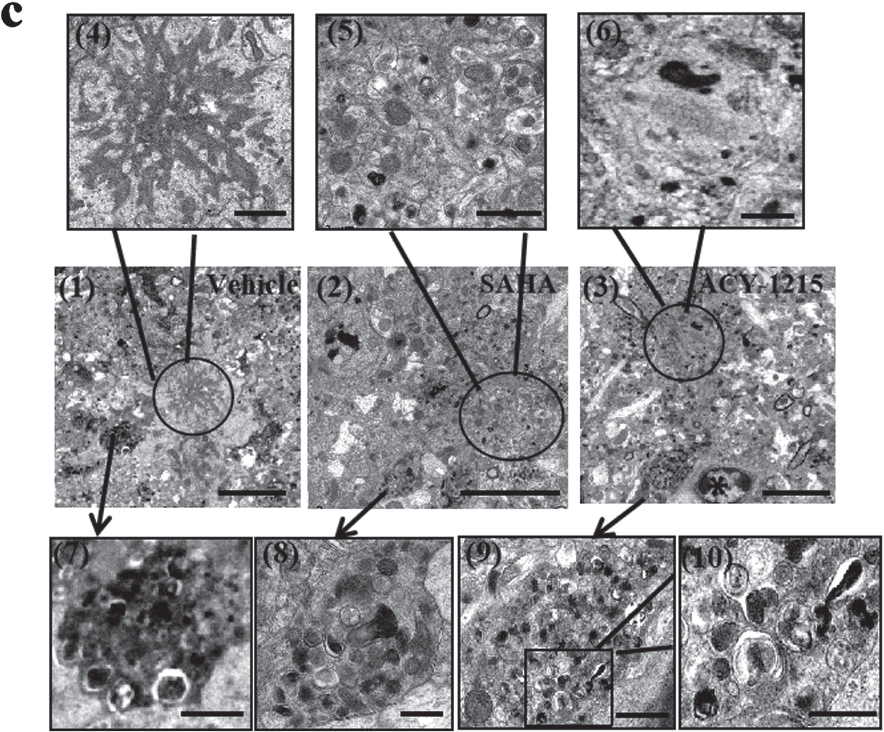 (c) Representative electron microscopy of senile plaques surrounded by dystrophic neurites, autophagic vesicles (AVs) and microglia (asterisk) in pre-frontal cortex of the three groups (vehicle, SAHA and ACY-1215). Flamelike plaque cores, present in the vehicle-treated group (1, 4), was absent in the HDAC6i-treated groups (2, 3, 5, 6). The number of AVs was reduced (7–10) and axon degeneration (2, 3) was improved in the HDACi-treated groups (n = 3). Scale bar: 5 μm (1, 2, 3); 1 μm (4–9); 500 nm (10).