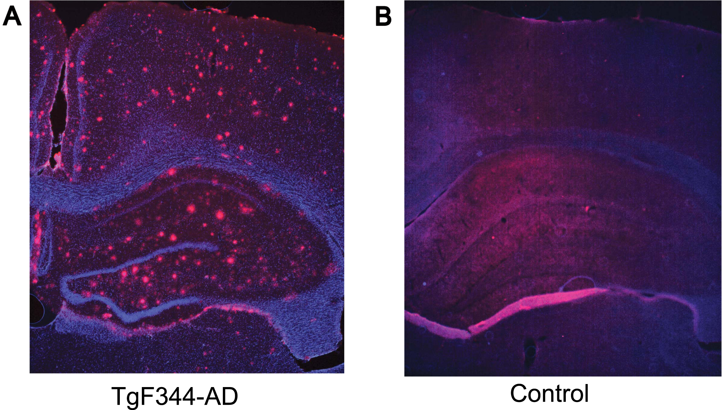 Hippocampal pathology in TgF344-AD rats (9–12 months). Representative images of amyloid-β (red) and DAP1 (blue) staining in 9–12 months old TgF344-AD (A) and control (B) rat. The coronal section from a transgenic rat (A) shows the accumulation of amyloid-β plaques throughout the hippocampus and cortex, while the control animal (B) exhibits no apparent pathology.