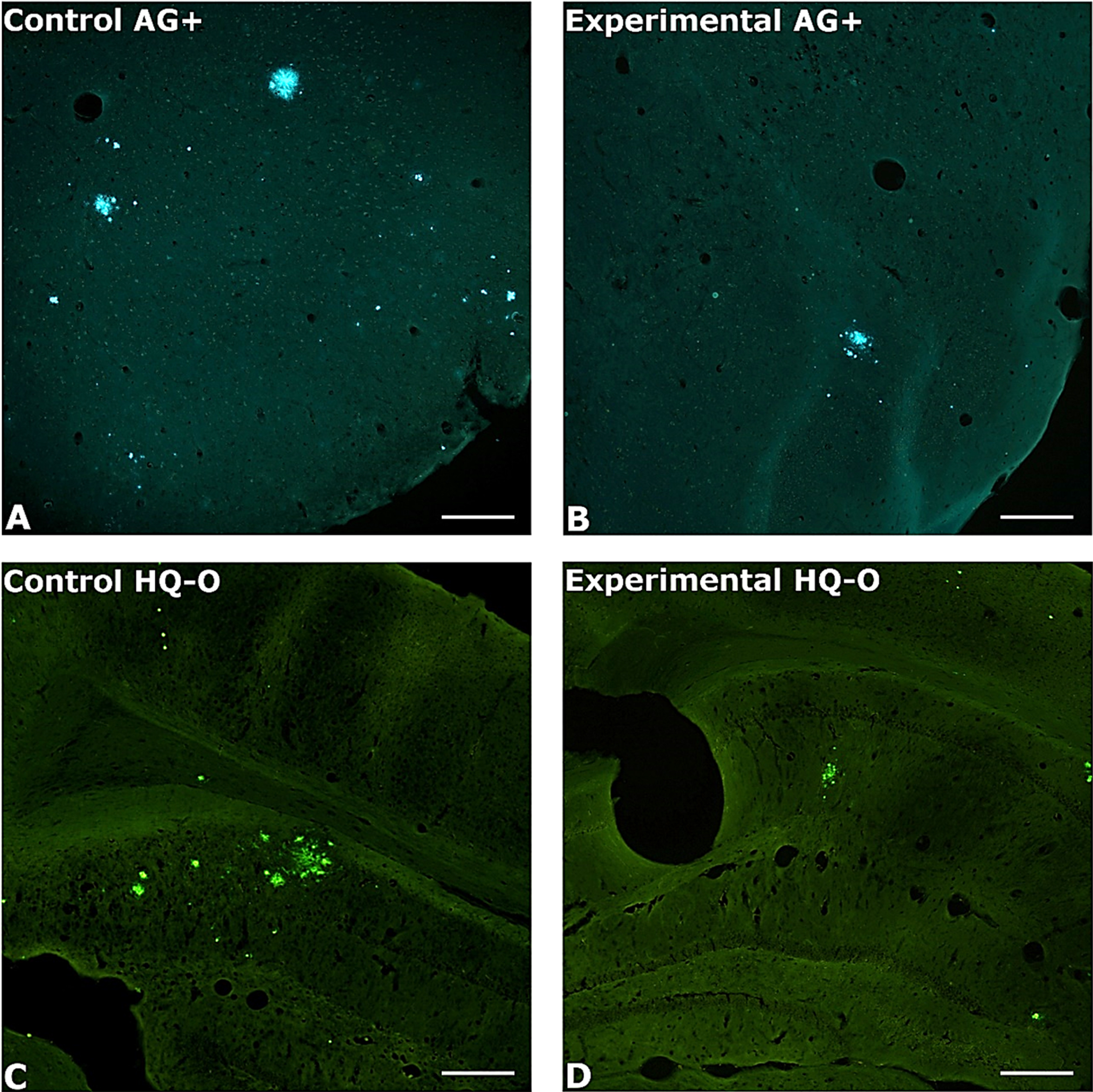 Photomicrography of amyloid plaques in untreated and treated mice. Photomicrographs illustrate the typical differences in amyloid plaque numbers and areas in control (left column) and PAA treated (right column) AβPP/Tau mice. Amyloid plaques were localized by staining with either AG (top row) or HQ-O (bottom row). Shown are A, B) perirhinal cortex, C) dorsal hippocampus, and D) ventral sensory-motor cortex. Amylo-Glo and HQ-O required ultraviolet or blue light excitation, respectively. Magnification bars = 600 μm.