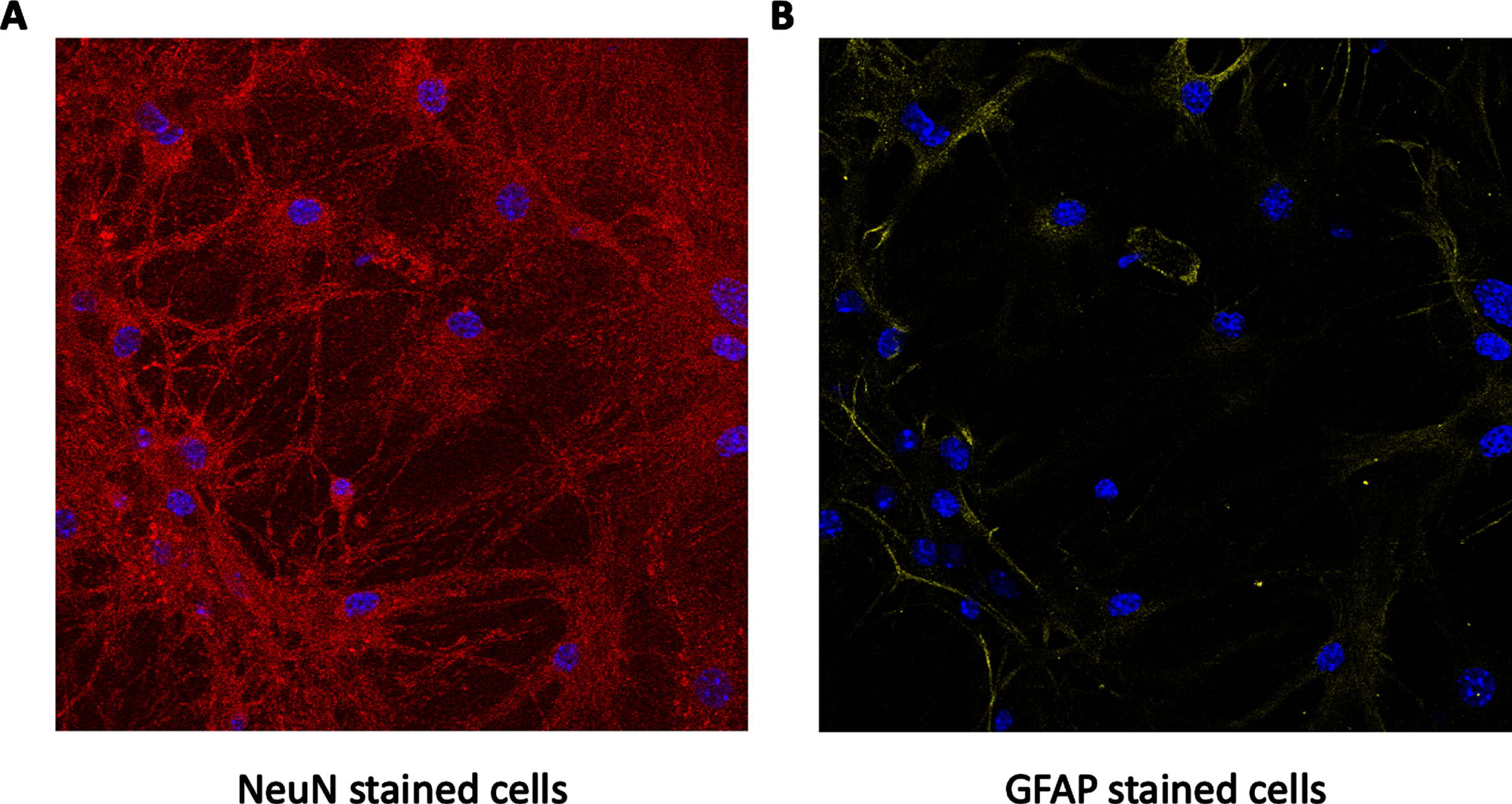 Neurons/astrocytes ratio in primary cultures. Primary cultures were stained for both NeuN (marked in red in A) and GFAP (marked in yellow in B). DAPI staining for cells’ nucleus is marked in blue. As can be seen, the levels of NeuN were much higher than those of GFAP, and together with the DAPI staining indicate that the culture is mostly neuronal, as expected.