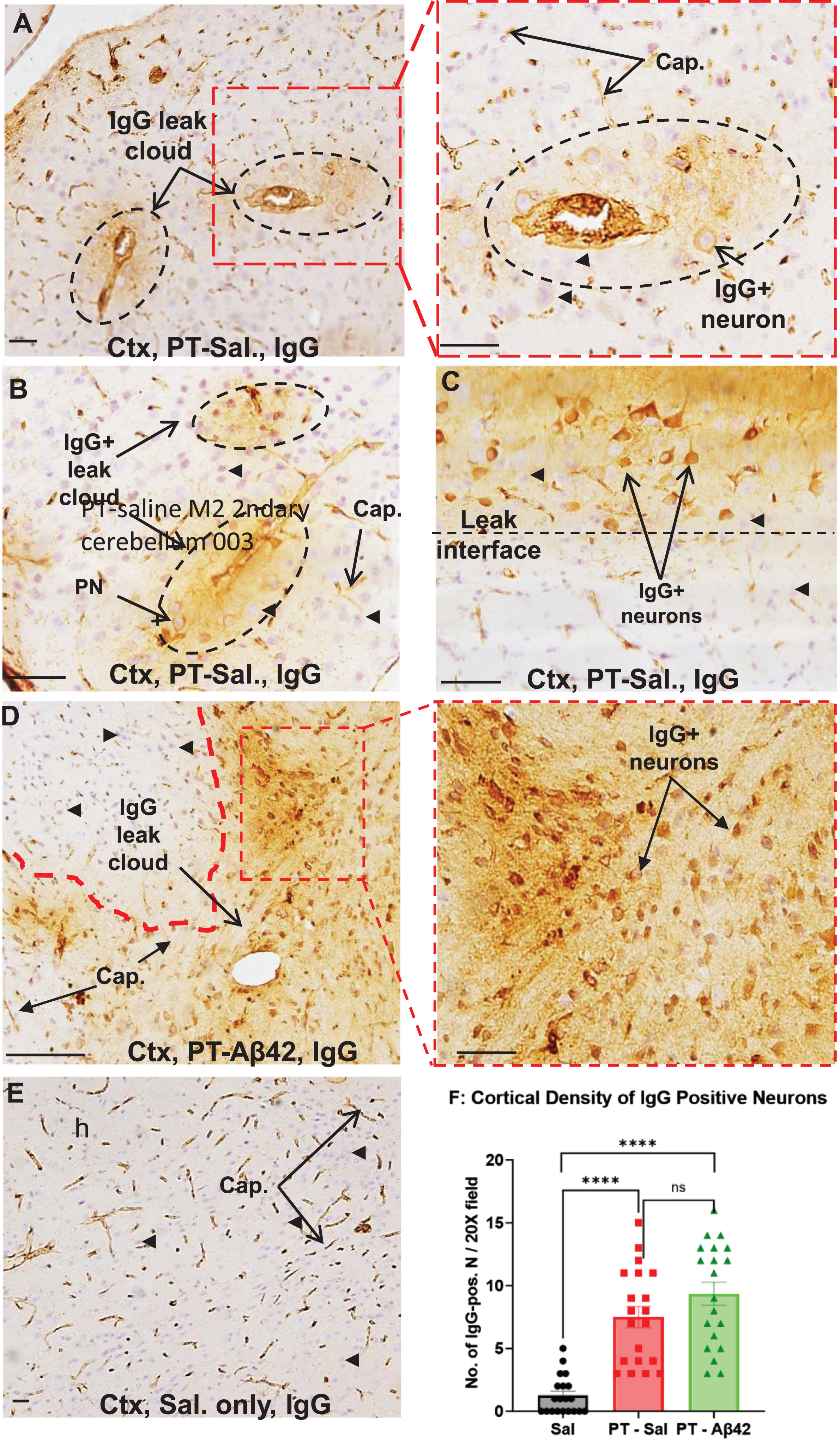 PT induces leak of plasma components and selective binding of IgG to local neurons. A–D) Histological sections from the mouse cerebral cortex (Ctx) showing the effects of long-term PT treatment on BBB permeability. BBB leak was revealed as increased IgG immunoreactivity either widespread throughout the parenchyma or as more focused perivascular leak clouds (enclosed by dashed circles), with sharp interfaces (C, D) of IgG immunoreactivity often observed. IgG-immunopositive neurons were present within or in the vicinity of leak clouds (A, C, D). Neurons positioned more remotely from the leak showed little or no IgG labeling (black arrowheads, A–C). D) PT-Aβ42 mice showed the most prominent IgG leaks and most extensive labeling of the neurons. The pyramidal neurons (PNs) outside of leak zones failed to demonstrate IgG immunoreactivity (black arrowheads). E) In the Sal-only group, IgG immunoreactivity was mostly localized within the blood vessels. F) Comparison between Sal-only and PT-Sal and Sal-only and PT-Aβ42 attained statistical significance (Mann-Whitney test, p < 0.0001). Though the PT-Aβ42 group demonstrated a higher number of PNs demonstrating IgG immunoreactivity compared to the PT-Sal group, it failed to attain statistical significance (Mann-Whitney test). Error bars indicate standard error of the mean (SEM). BV, blood vessel; Cap, capillary; Ctx, cerebral cortex. Scale bar = 50μm.