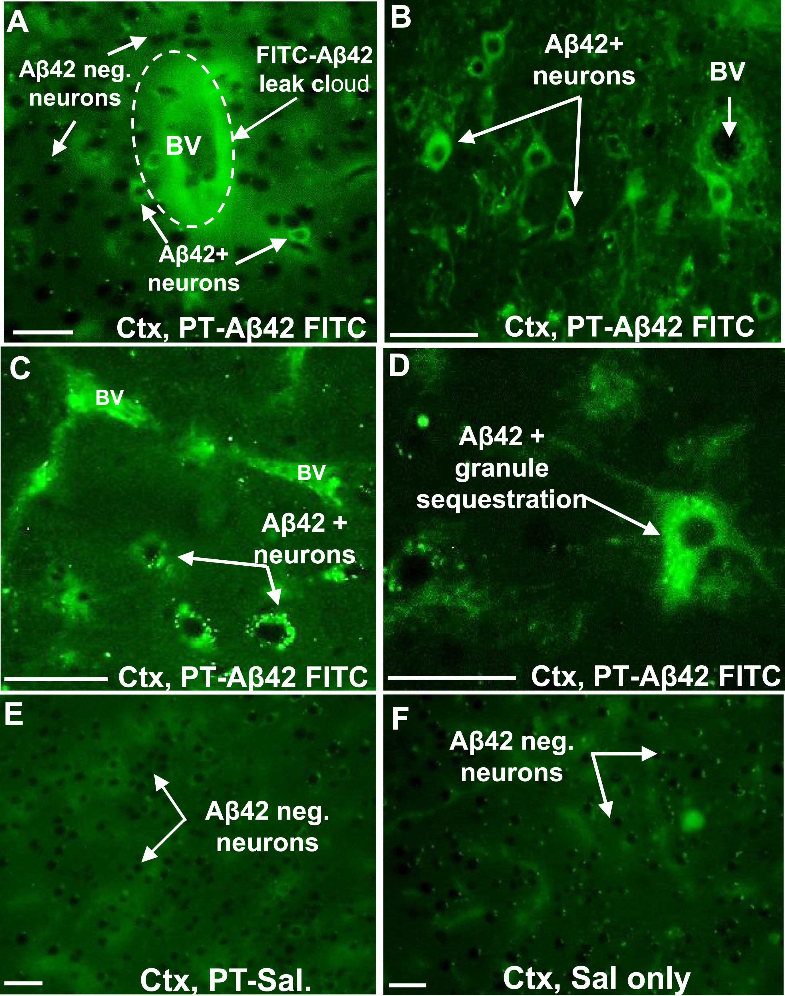 FITC-labeled A
β42 enters the brain parenchyma, shows selective affinity for pyramidal neurons, and is internalized within these cells. A–D) In the cerebral cortex of mice injected with PT and FITC-Aβ42, FITC-Aβ42 leaks out from blood vessels (white dashed circle in A) and is selectively internalized in pyramidal neurons (B–D). In neurons, FITC-Aβ42 was localized within numerous discrete granules in the neuronal perikaryon, suggesting that cell surface-bound FITC-Aβ42 is internalized and accumulates within a membrane-enclosed compartment. E, F) Background fluorescence in the cerebral cortex of mice not exposed to FITC-Aβ42 [i.e., PT-Sal (E) and Sal-only (F)] mice. No punctate immunofluorescence like FITC-Aβ42 was seen in PT-Sal (E) and Sal-only (F) mice. PN, Pyramidal neurons: BV, blood vessel; Cap, capillary; PT, Pertussis toxin; Ctx, cerebral cortex. Scale bar = 50μm.