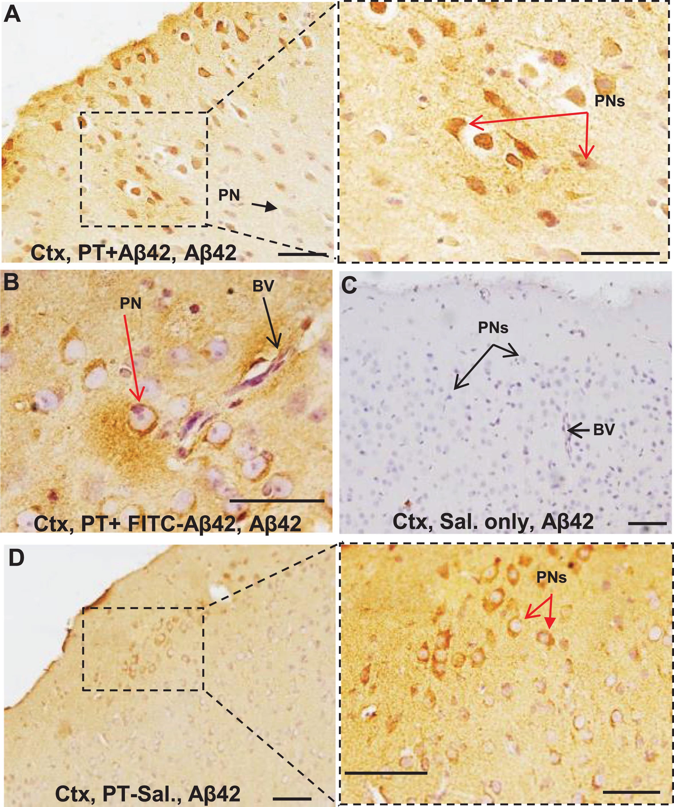 Cortical pyramidal neurons in mice treated with PT + unlabeled A β42 (U-Aβ42) peptide showed an increase in intraneuronal A β42 accumulation comparable to that seen in mice treated with PT+FITC-labeled Aβ42 (FITC-Aβ42) peptide. Bright-field immunohistochemistry with anti-Aβ42 primary antibody was used to compare the fates of injected U-Aβ42 and FITC-Aβ42 in the context of PT-induced chronic BBB breakdown. A, B) Both PT + U-Aβ42- and PT + FITC-Aβ42-treated mice demonstrated increased neuronal accumulation of Aβ42 in the cerebral cortex (Ctx), red arrows. C) No evidence of neuronal Aβ42 deposition was observed in Sal-only mice. D) Mice in the PT-Sal group also demonstrated some intraneuronal Aβ42, but this was much less extensive and was often largely confined to small, isolated groups of neurons. This suggests that soluble, endogenous mouse Aβ42 is also able to enter the brain parenchyma through a defective BBB. It is important to point out that, using the bright field microscopy, we are unable to differentiate between endogenous Aβ42 peptides from the FITC-Aβ42 peptide. PN, pyramidal neuron; BV, blood vessel; Cap, capillary; PT, Pertussis toxin; Sal, saline. Scale bar = 50μm.