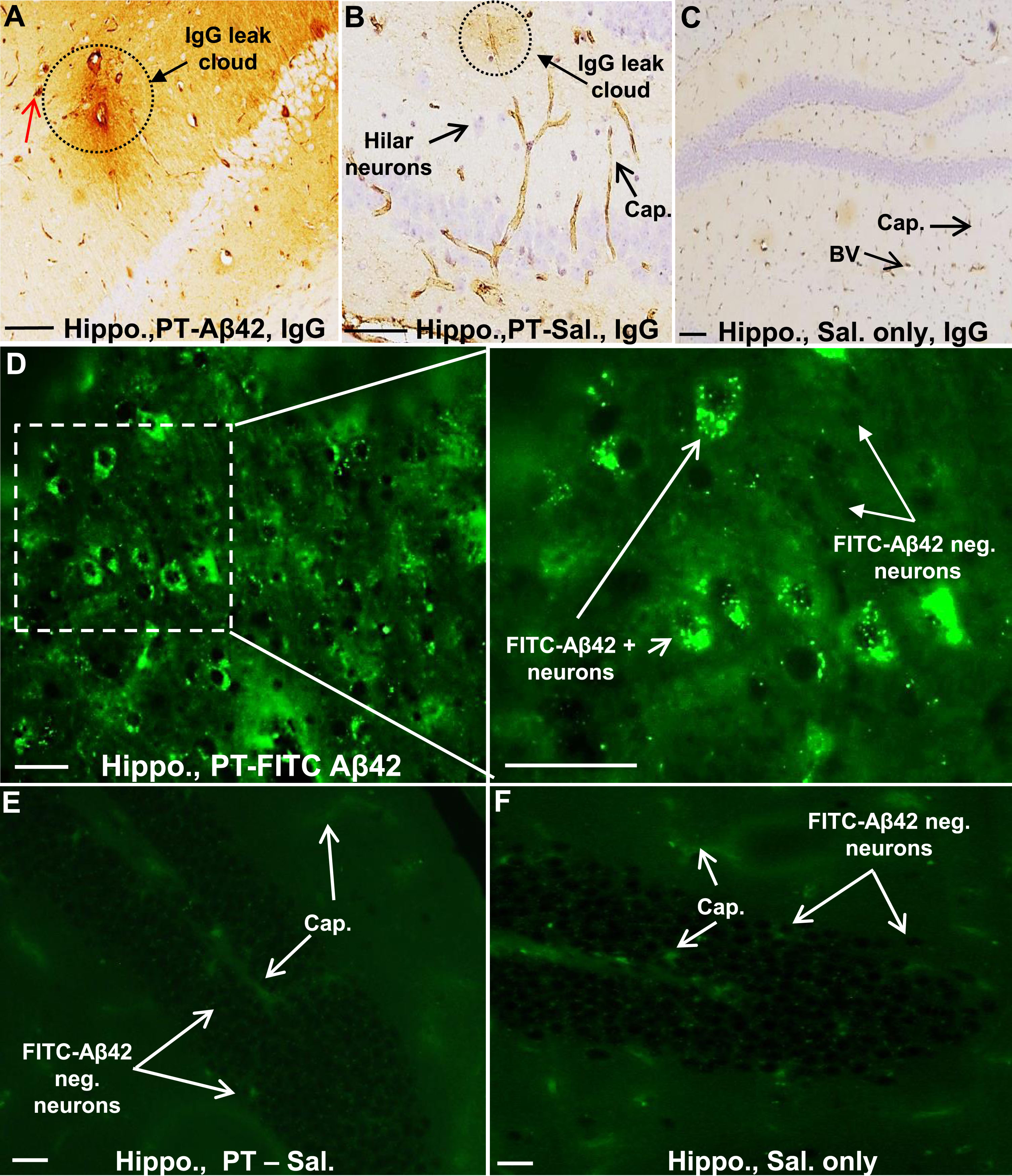 The hippocampal region of PT -A
β42 mice also showed increased BBB breakdown and intraneuronal accumulation of FITC-A
β42. A–C) Representative images from paraffin-embedded sections through the hippocampal region of PT-Aβ42 mice showing extensive BBB leak of IgG compared to PT-only and Sal-only groups. D) Representative images from PT-FITC-Aβ42-treated mice demonstrating intraneuronal accumulation of FITC-Aβ42 in hippocampal hilar neurons. E, F) The hippocampal region of the PT-Sal and Sal-only mice lacked FITC-positive fluorescence. Hippo, hippocampus; BV, blood vessel; Cap, capillary. Scale bar = 50μm.
