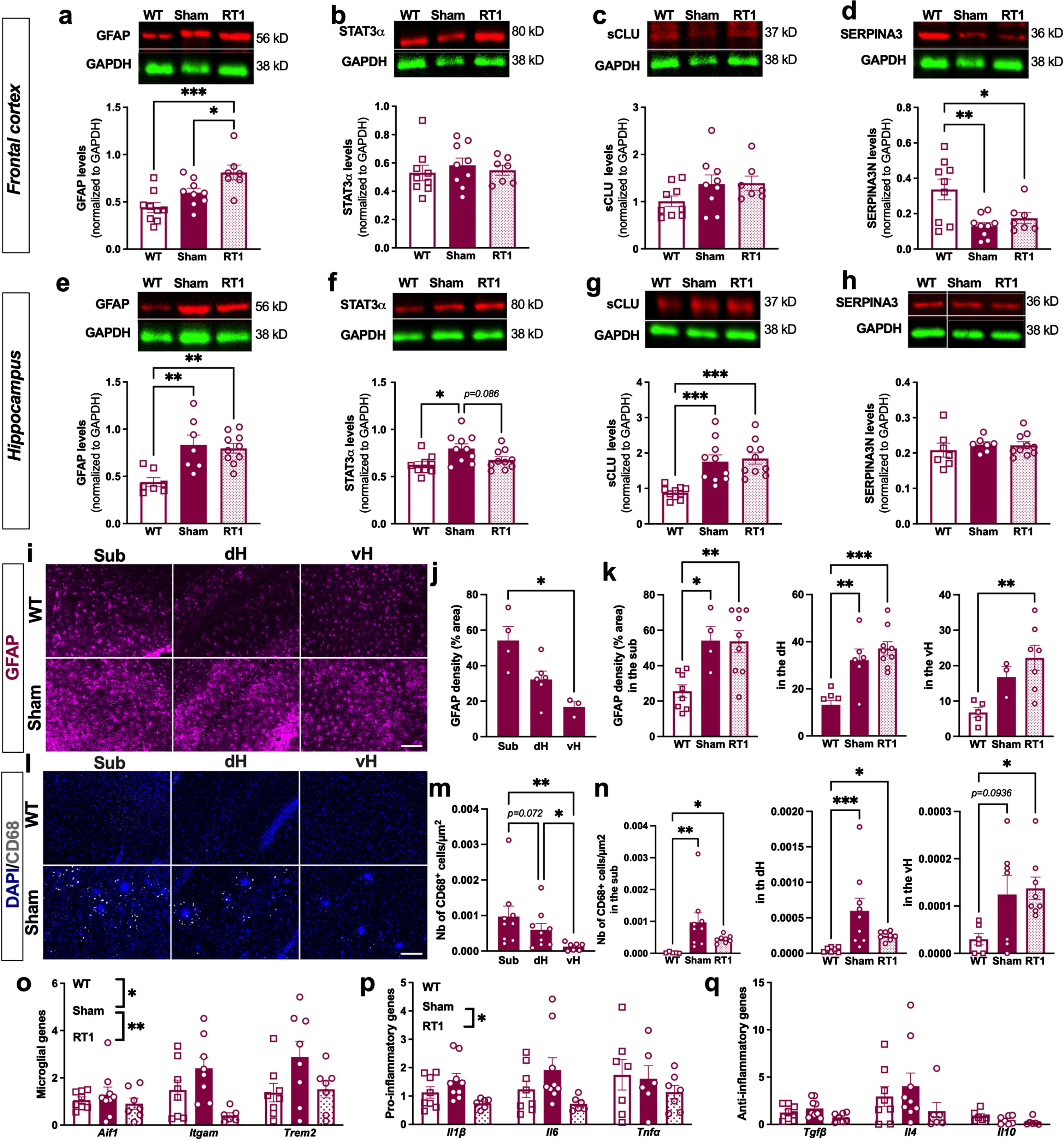LD-RT reduces microglial inflammation markers in early AD females. Quantification of astrocytic markers including GFAP (a), STAT3α (b), secreted CLUSTERIN (sCLU) (c), and SERPINA3 N (d) levels by western blot in the frontal cortex. Quantification of GFAP (e), STAT3α (f), secreted CLUSTERIN (sCLU) (g), and SERPINA3N (h) levels by western blot in the hippocampus. Data are normalized to GAPDH levels. One-way ANOVA and Tukey’ multiple comparisons test. i) Representative images of GFAP (magenta) staining in the subiculum (sub), dorsal hippocampus (dH) and ventral hippocampus (vH) of WT and sham treated TgAD rats. Scale bar = 100 μm. j) Quantification of the GFAP density (% positively stained area) in the Sub, dH and vH in sham-treated TgAD rats. k) Quantification of the GFAP density (% positively stained area) in the different groups in the sub, dH and vH. l) Representative images of CD68 (grey; merged with DAPI in blue) staining in the sub, dH and vH of WT and sham treated TgAD rats. Scale bar = 100 μm. m) Quantification of the number of CD68+ cells/μm2 in sham-treated TgAD rats. n) Quantification of the number of CD68+ cells/μm2 in the different groups in the sub, dH and vH. One-way ANOVA and Tukey’s multiple comparisons test or Kruskal-Wallis and Dunn’s multiple comparisons test. (o–q) mRNA levels quantified by qPCR in the cortex of animals. Two-way ANOVA (group and gene as between factors) and Tukey’s multiple comparisons test. # or *p < 0.05, **p < 0.01, ***p < 0.001.