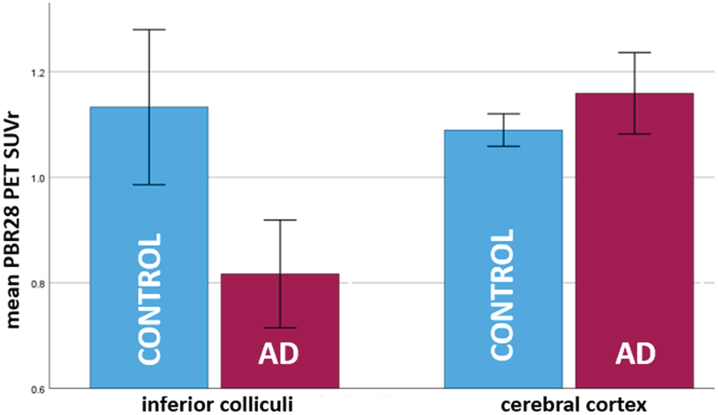 Bar plot showing opposite patterns of TSPO expression/microglial activation (PBR PET SUVr) in inferior colliculi and cerebral cortex in 8 AD subjects versus 20 healthy controls. In inferior colliculi, TSPO expression was lower in AD subjects as compared to controls (p = 0.004). This is a novel finding. In cerebral cortex, TSPO expression was greater in AD subjects as compared to controls (p = 0.04). This is in accord with several prior studies [5–7]. PBR PET SUVr is calculated over bilateral regions. Error bars = 95% confidence intervals.