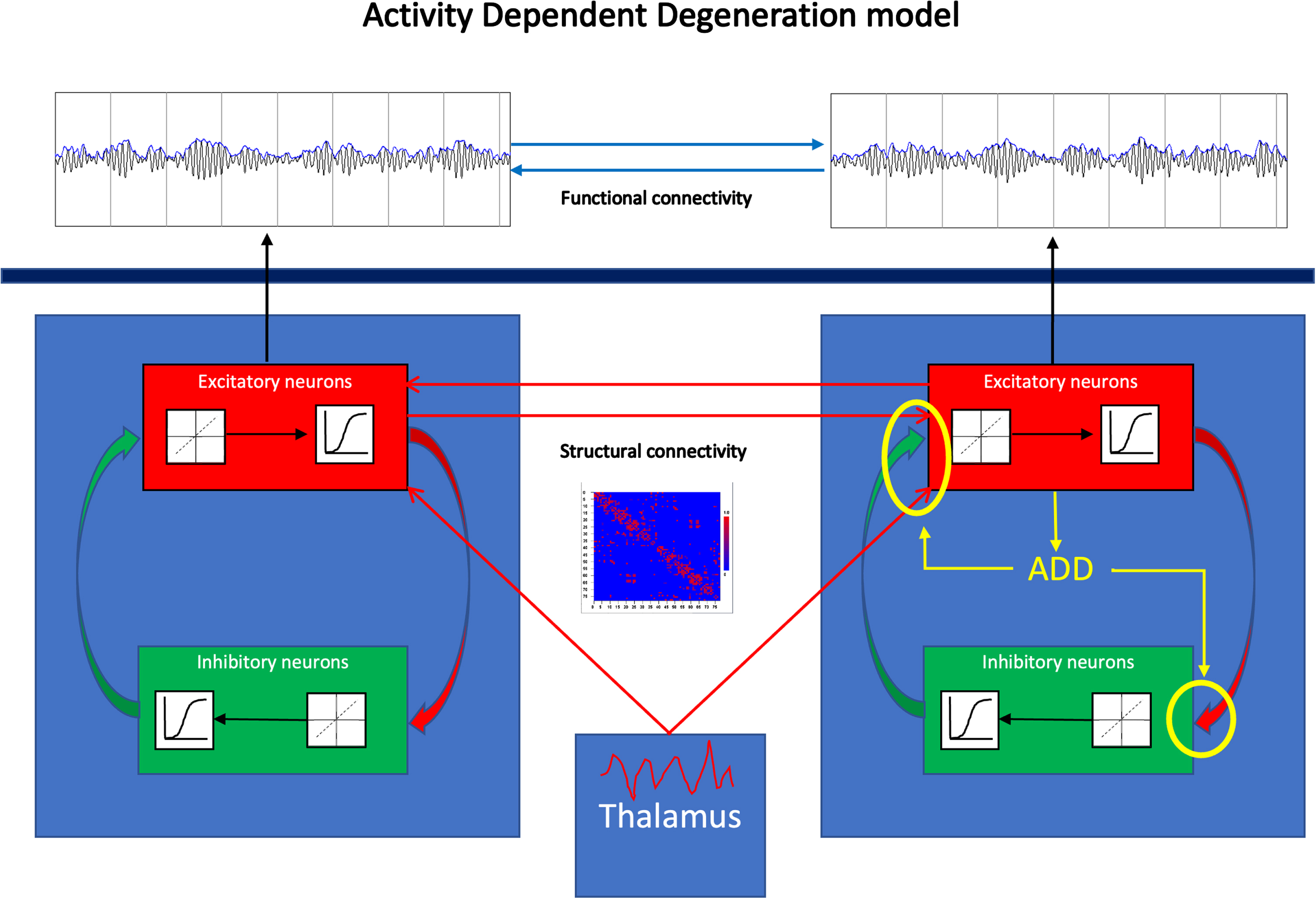 General scheme of the activity dependent degeneration (ADD) model. The brain is modeled as a network of coupled brain regions. The activity of each brain region, corresponding to the two blue squares to the left and the right, is described by a neural mass model. This considers the average activity (mean membrane potential and mean firing rates in spikes/s) of reciprocally interconnected populations of excitatory and inhibitory neurons, indicated by the red and green boxes within the larger blue boxes. Within each population incoming action potentials are converted to changes in mean membrane potential by a dynamic linear function. Membrane potentials are converted to spike densities by a static nonlinear (sigmoidal) function. Excitatory neurons of different brain regions are coupled to excitatory neurons of other brain regions, where the presence and strength of such connections is based upon an underlying structural connections matrix (example shown in the middle of the figure). All brain regions receive excitatory input to their excitatory neurons from the thalamus. The output of the model consists of time series of membrane potentials of the excitatory population of each of the brain regions. As shown in yellow in the right brain region ADD is implemented by coupling the firing rates of the excitatory population to weakening of all synapses, excitatory as well as inhibitory, present in the system.